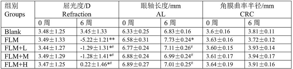 Traditional Chinese medicine composition and preparation for treating myopia