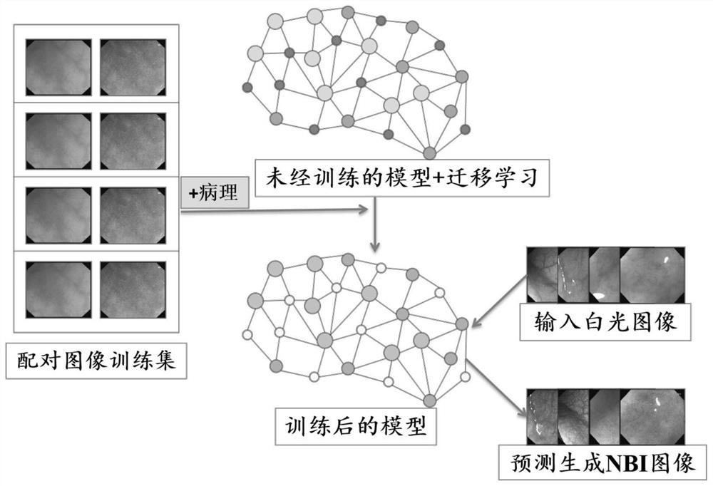Convolutional neural network model for predicting and generating NBI image according to endoscope white light image and construction method and application of convolutional neural network model
