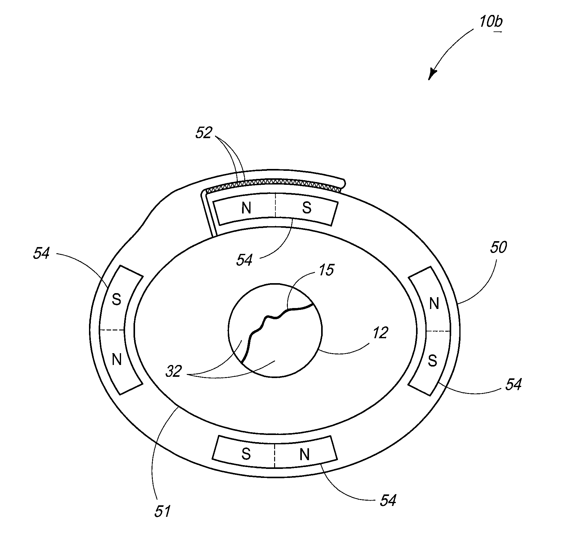 Fractured Bone Treatment Methods And Fractured Bone Treatment Assemblies