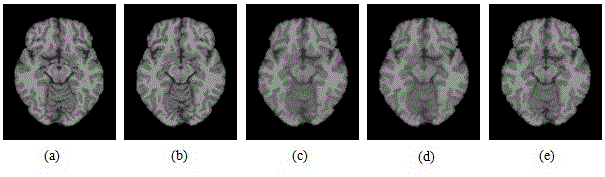 Brain MR image registration method based on anisotropic optical flow field and debiasing field