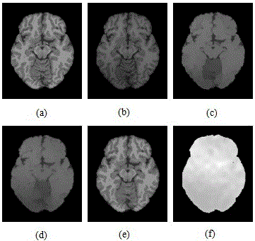 Brain MR image registration method based on anisotropic optical flow field and debiasing field