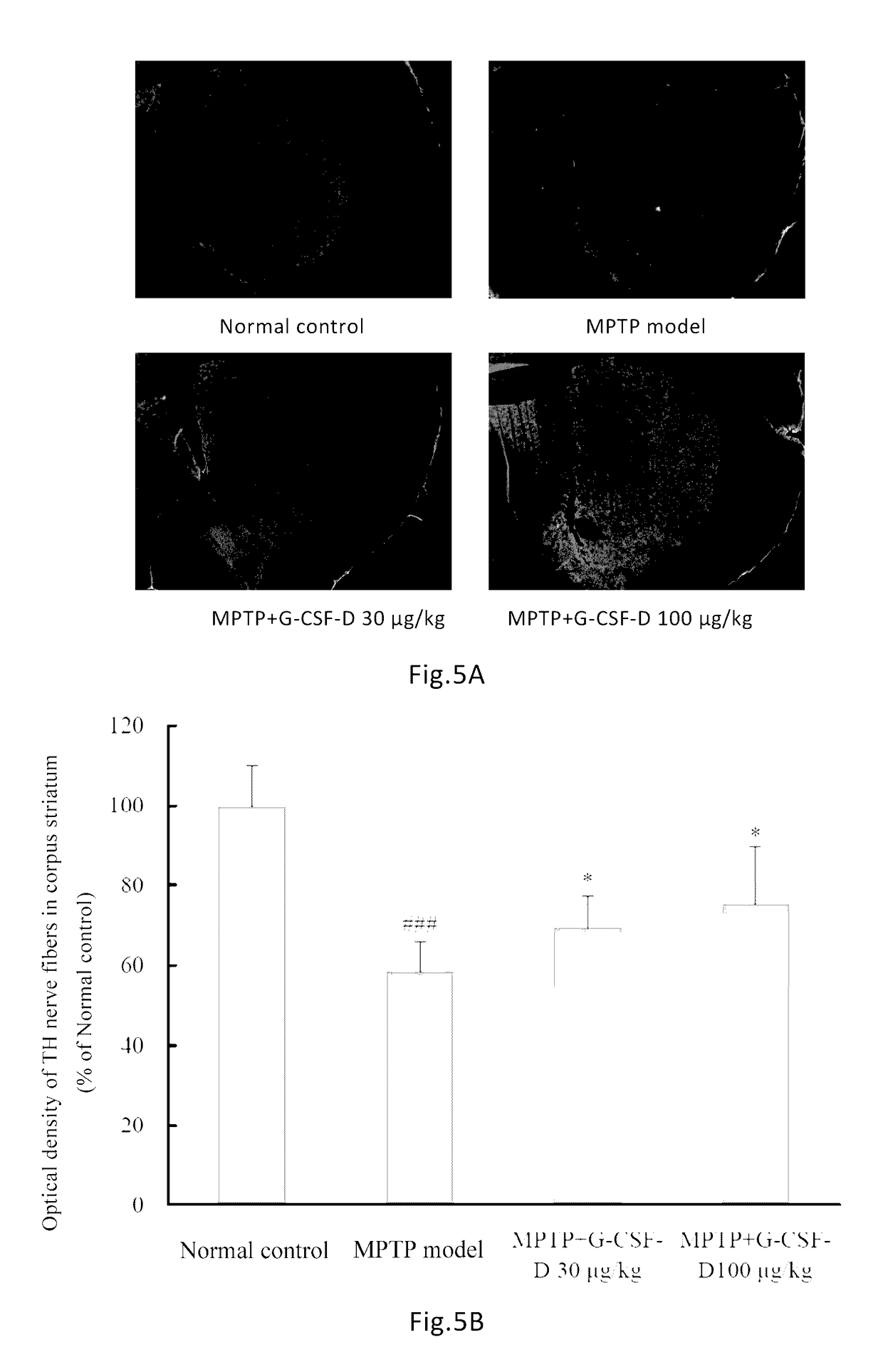 Use of G-CSF dimer in preparation of medicament for treatment of neurodegenerative diseases