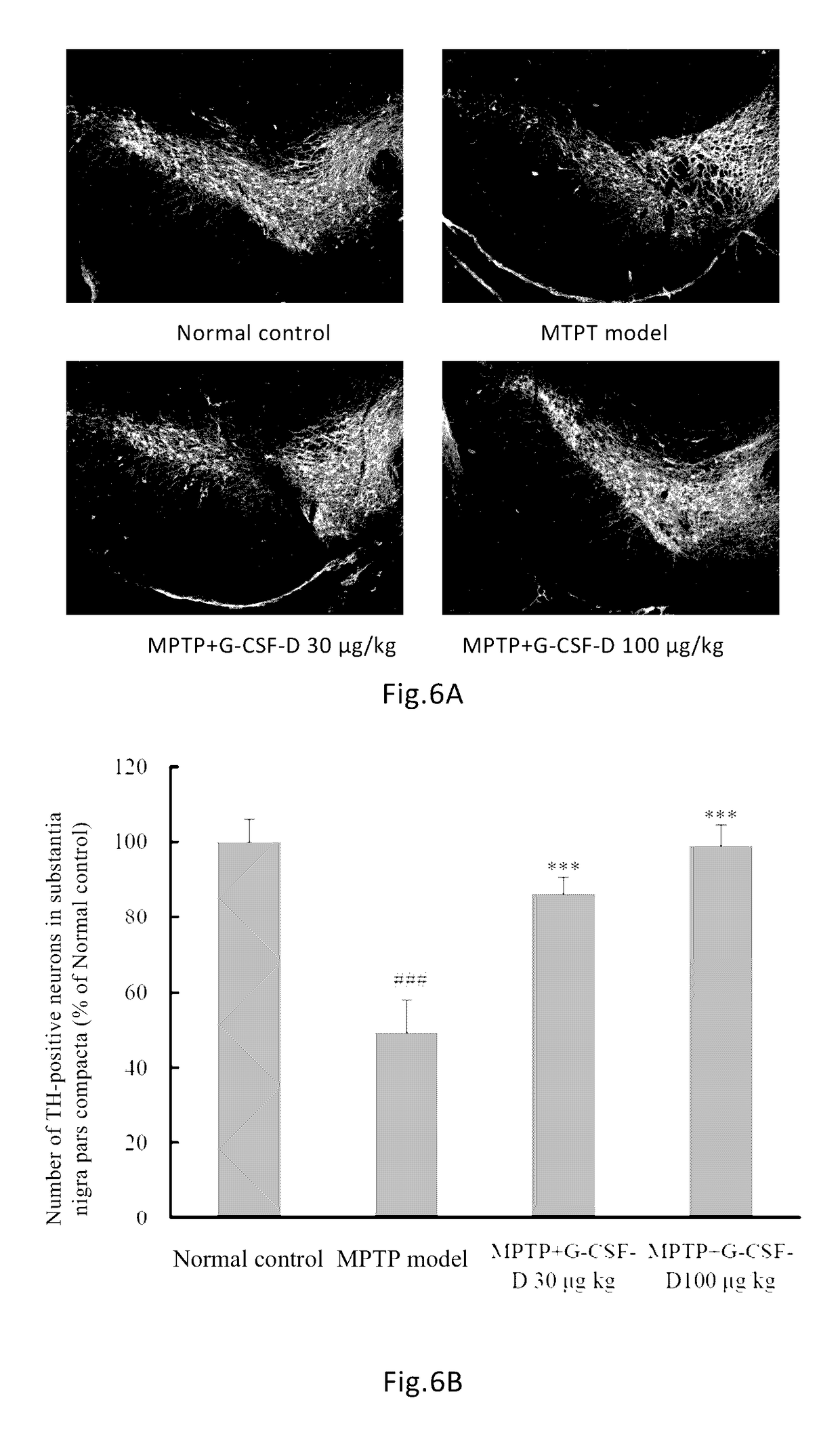 Use of G-CSF dimer in preparation of medicament for treatment of neurodegenerative diseases