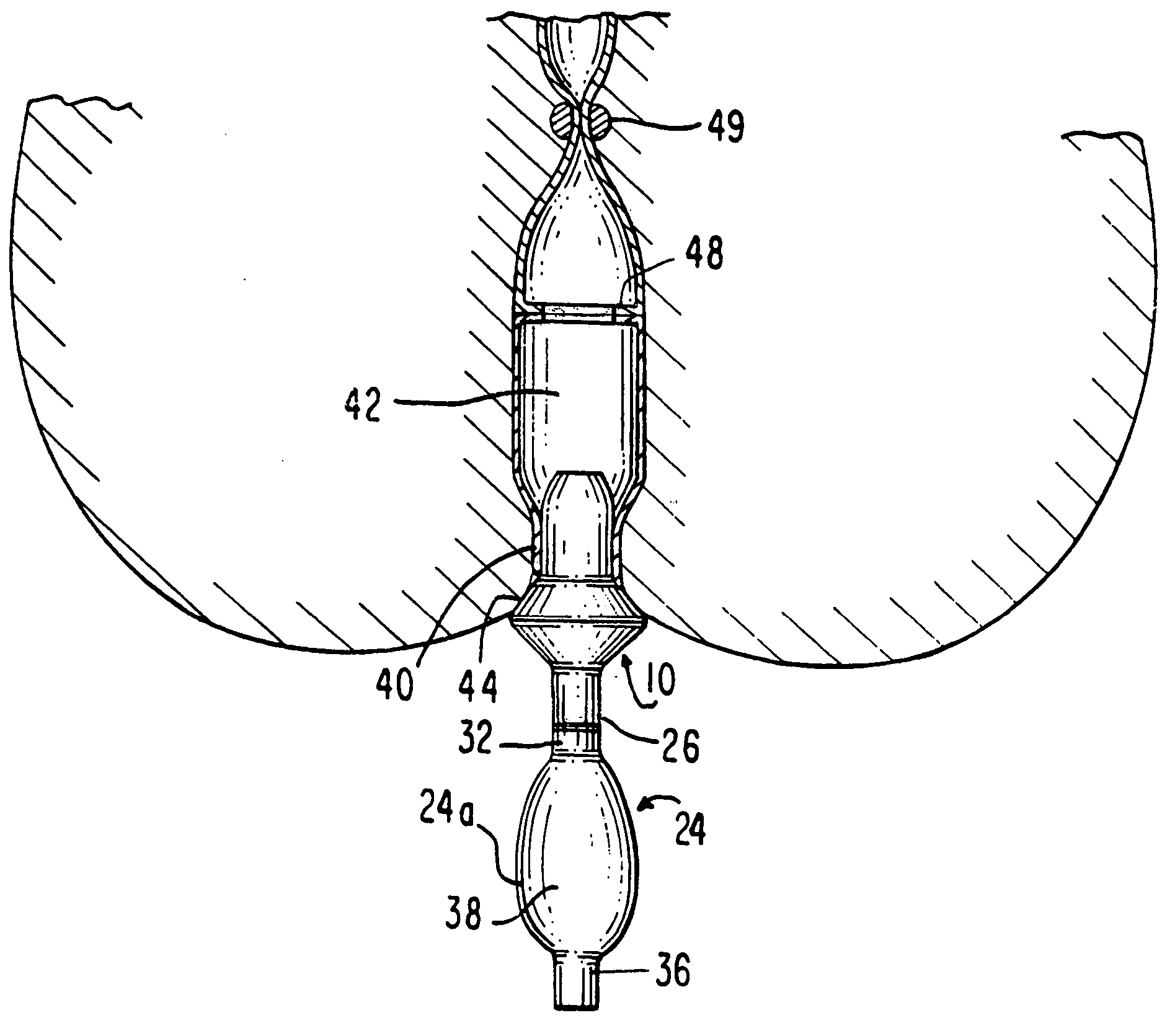 Air introduction device for anastomotic leak testing