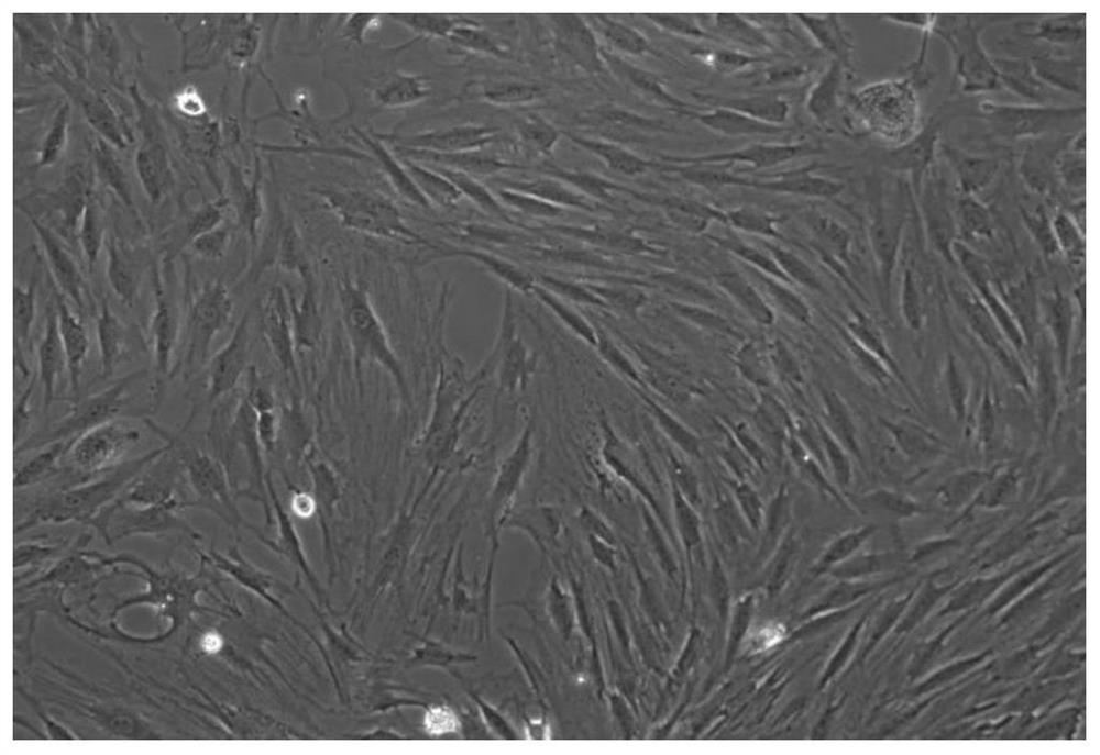 An active polypeptide capable of promoting osteogenesis and inhibiting osteoclastolysis and its application