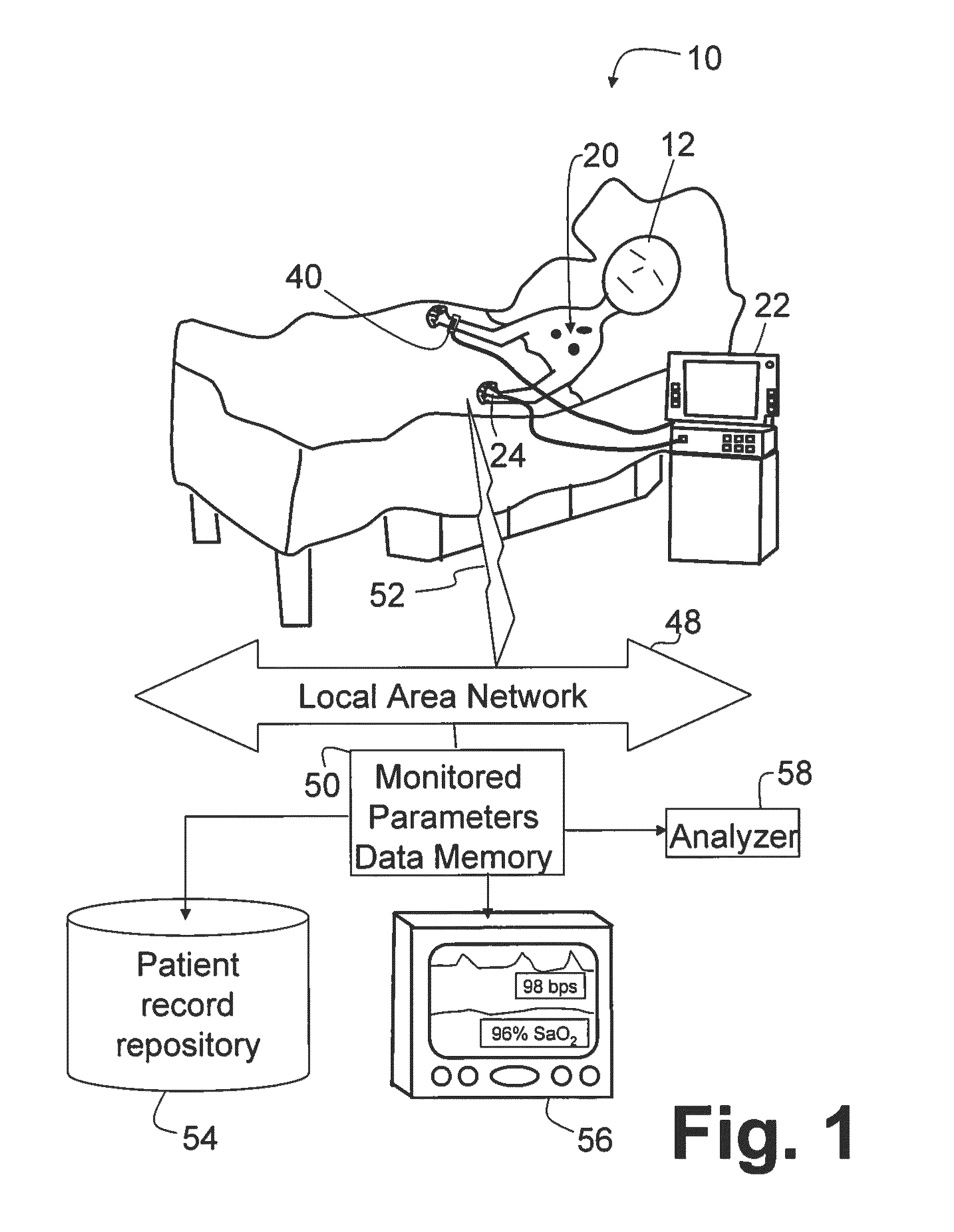 Apparatus to measure the instantaneous patients' acuity value