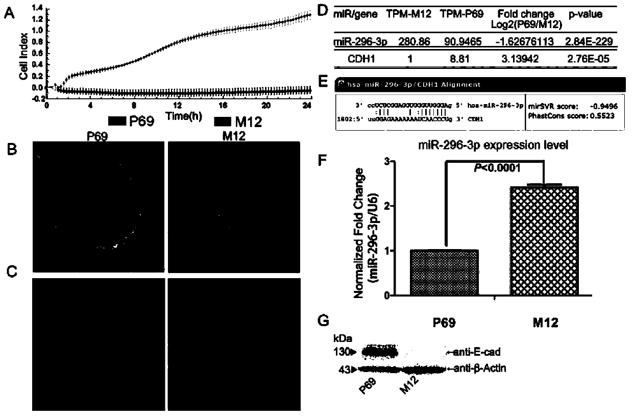 Application of miR-296-3p to preparation of kit for diagnosing prostate cancer generation or migration