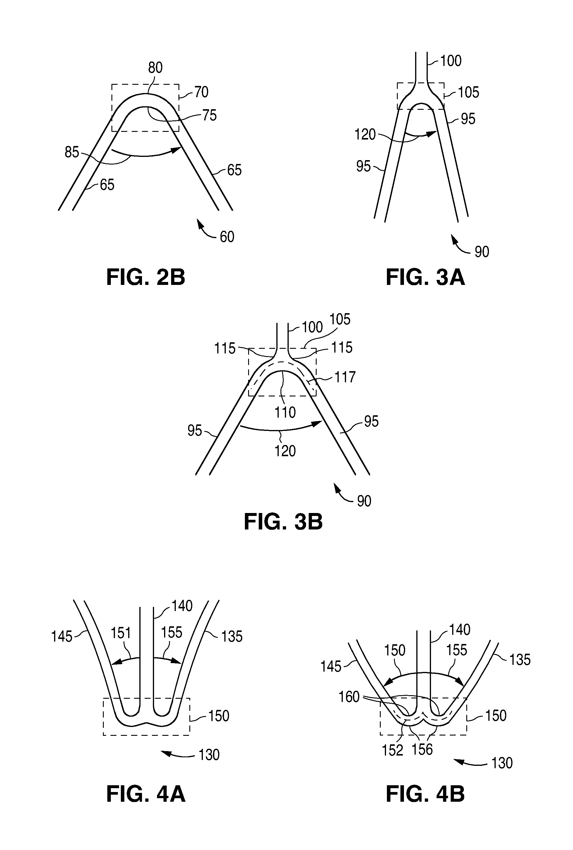 Medical Device with Regioselective Structure-Property Distribution