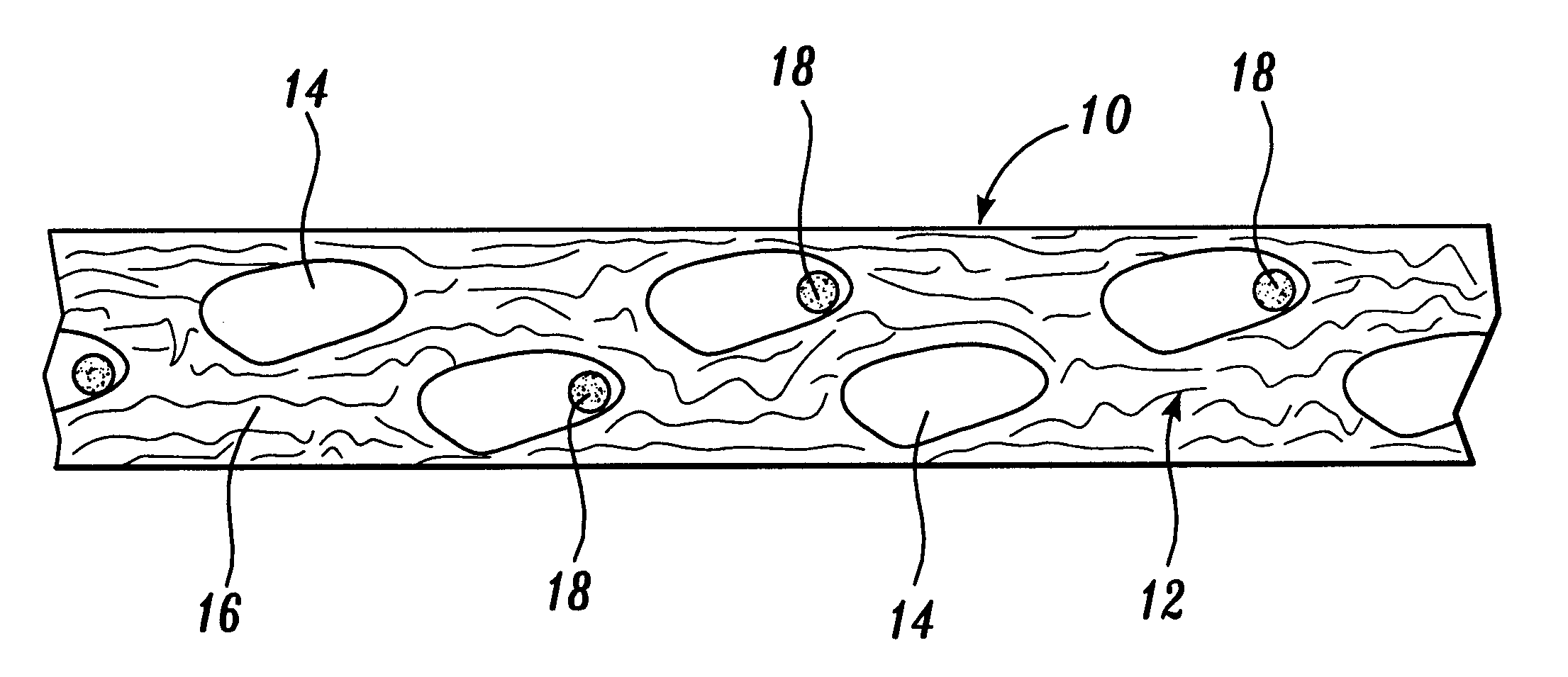 Reticulated absorbent composite