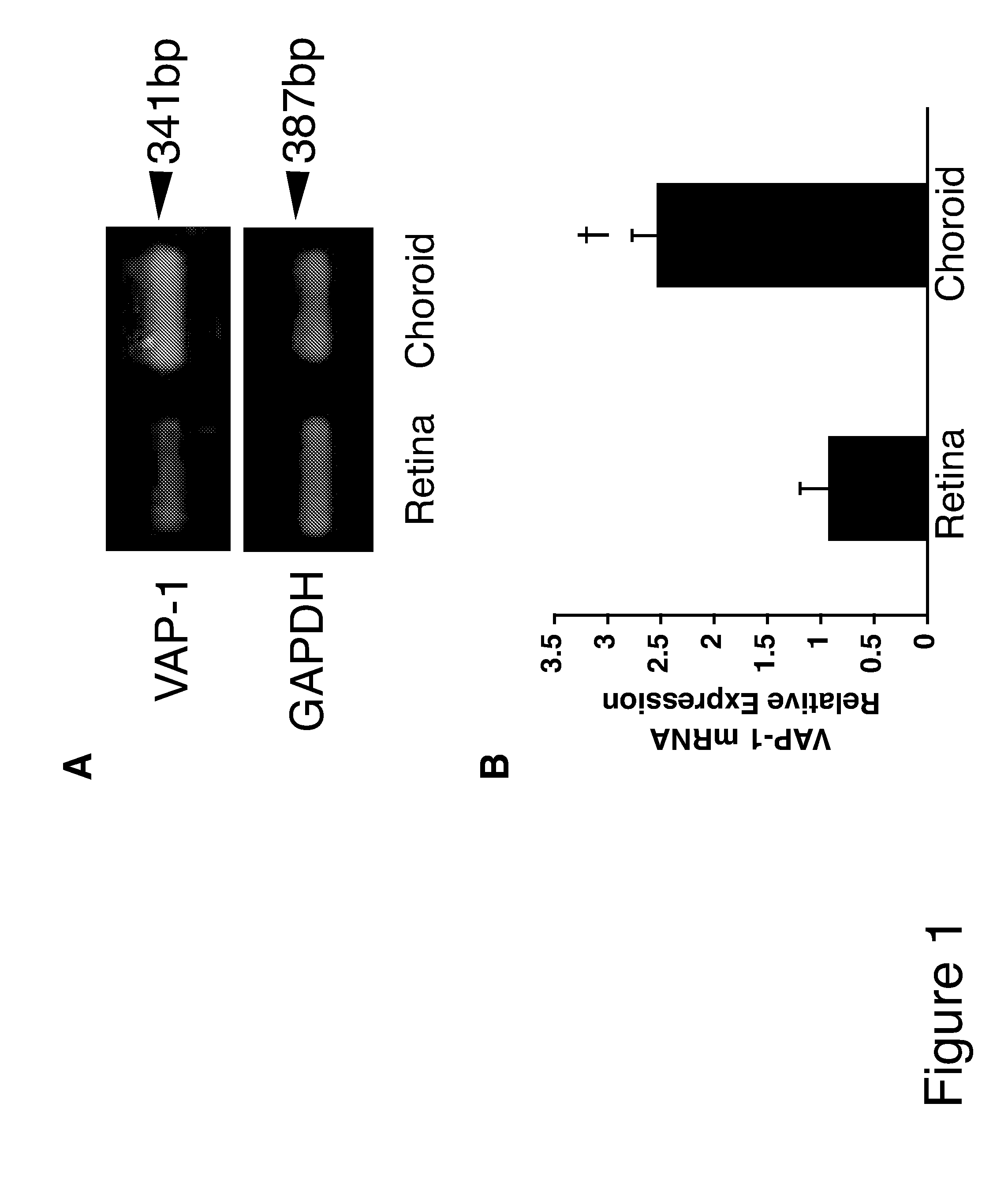 Methods and compositions for treating conditions associated with angiogenesis using a vascular adhesion protein-1 (vap-1) inhibitor