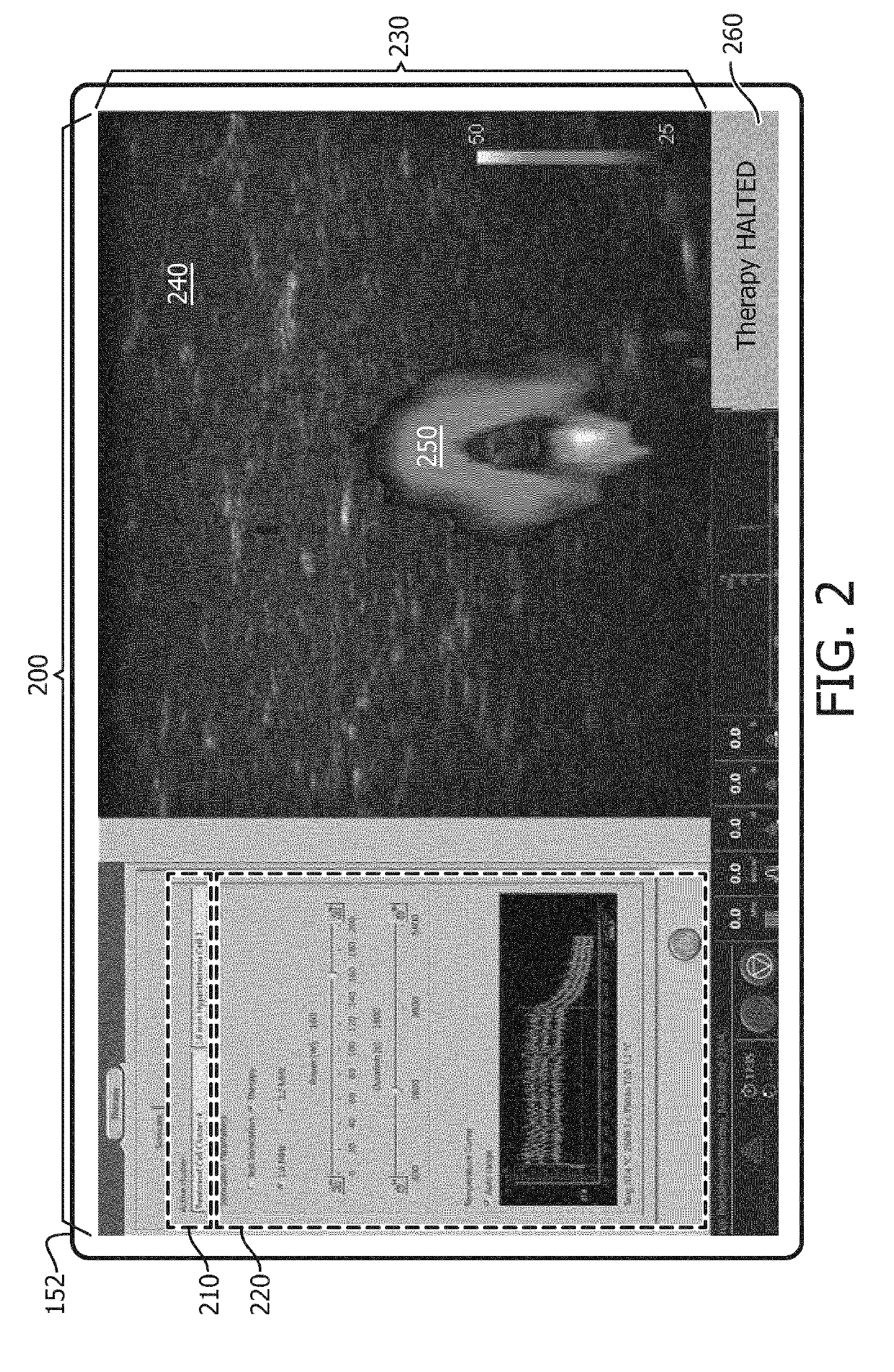 Detection of treatment failure for mild hyperthermia