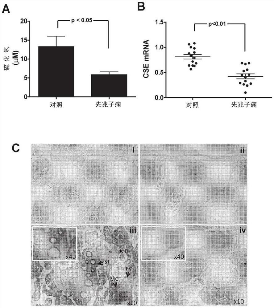 Hydrogen sulphide compounds capable of stimulating h2s production in a pregnant subject