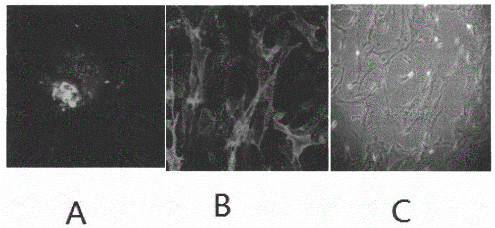 Pretreatment method of mesenchymal stem cells and preparation obtained from mesenchymal stem cells
