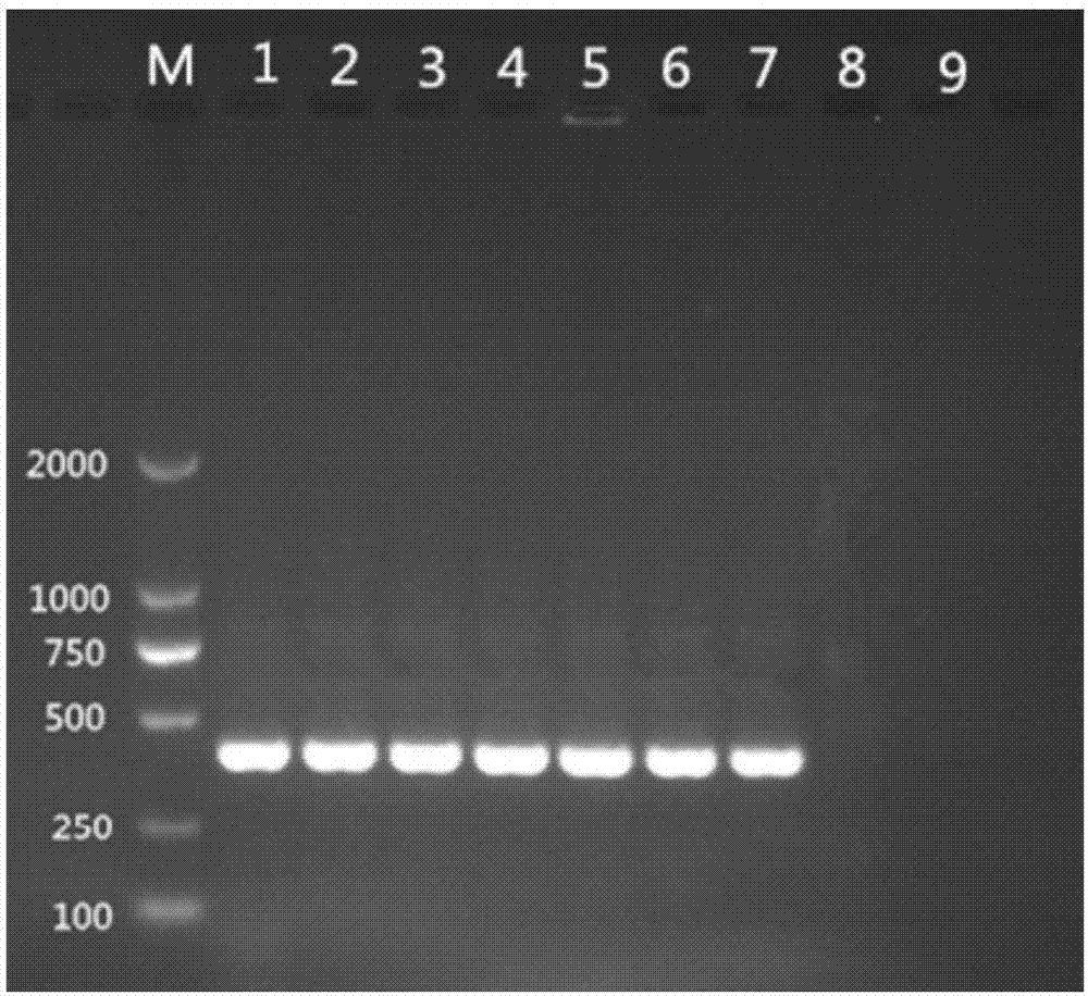 Pseudocercospora rDNA and application thereof to molecular detection of pseudocercospora