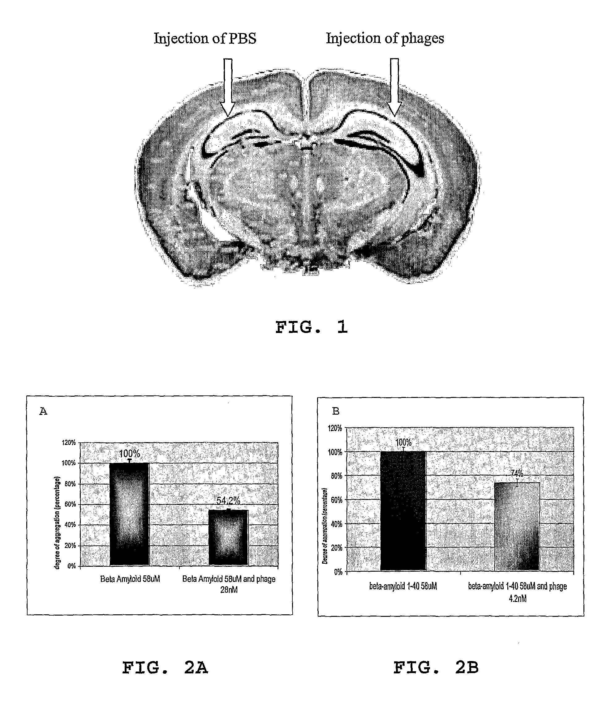 Method for treating inflammation associated with amyloid deposits and brain inflammation involving activated microglia