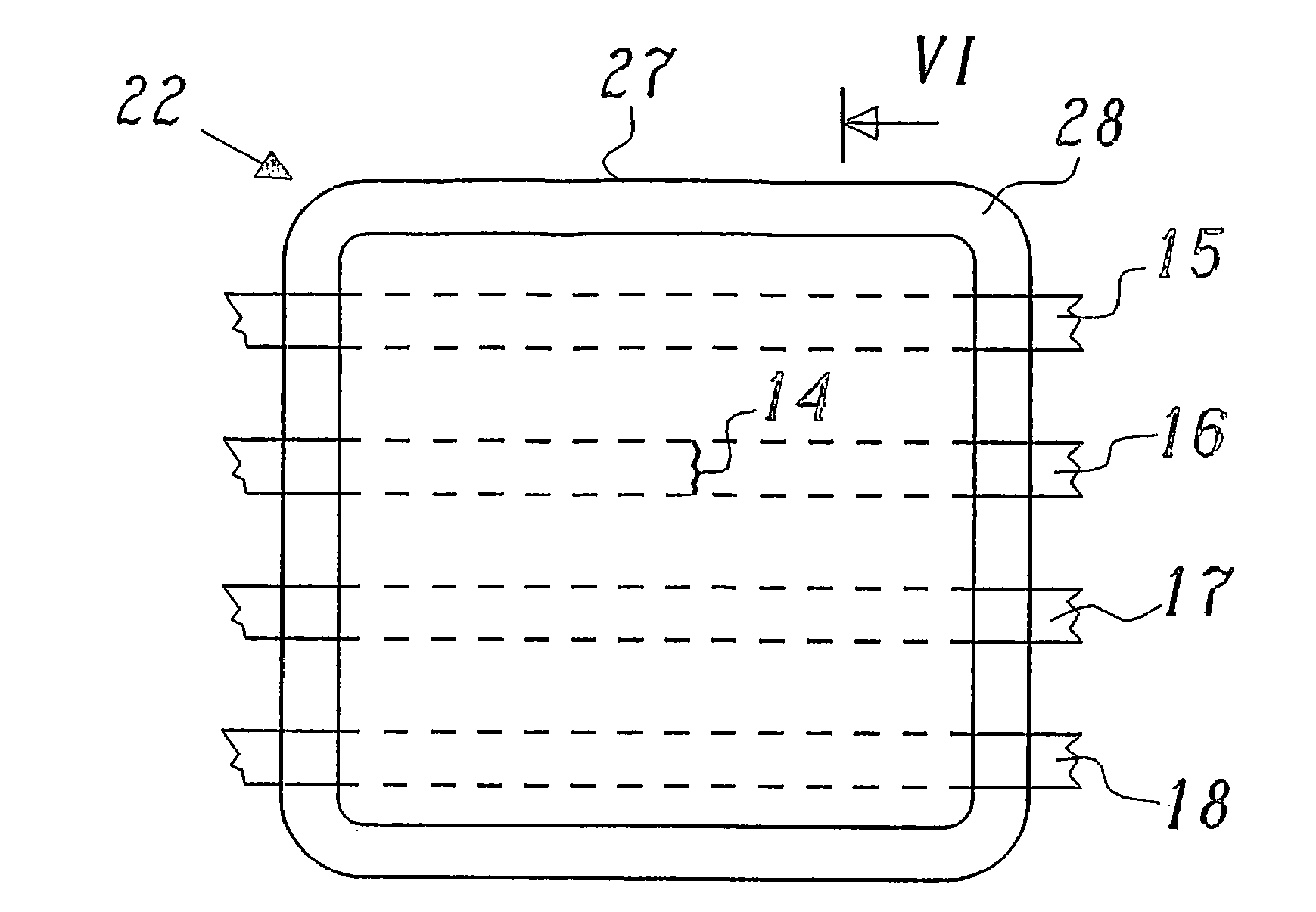 Device and method for analgesic immobilization of fractured ribs