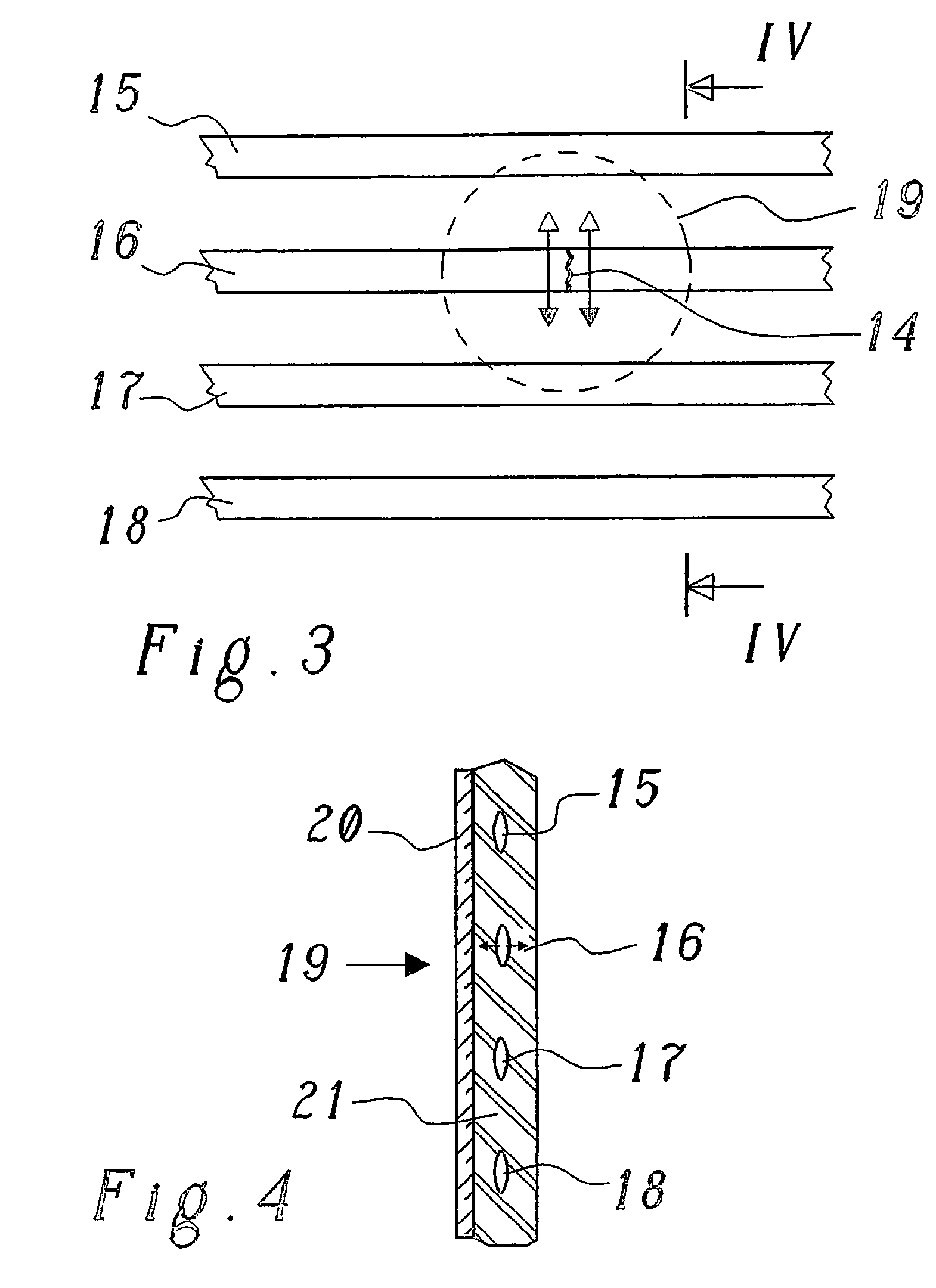 Device and method for analgesic immobilization of fractured ribs
