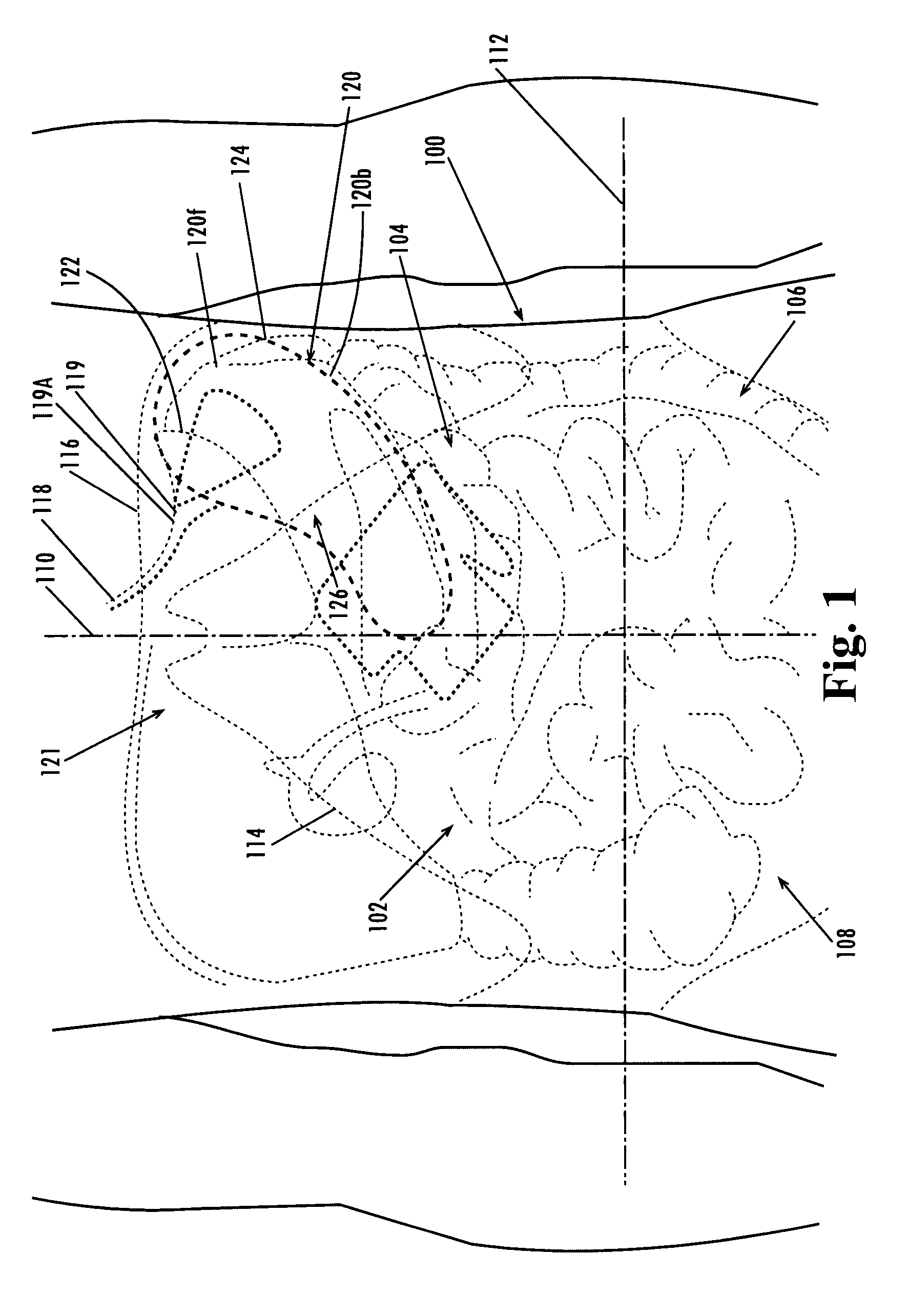 Devices and methods for treatment of obesity