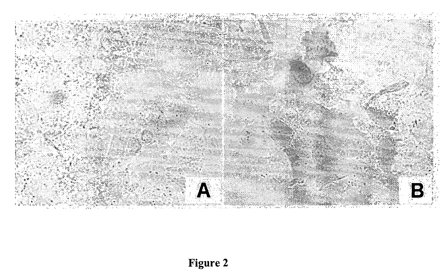 Heterocyclic compounds based on n6-substituted adenine, methods of their preparation, their use for preparation of drugs, cosmetic preparations and growth regulators, pharmaceutical preparations, cosmetic preparations and growth regulators containing these compounds