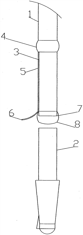 Stomach tube cannula