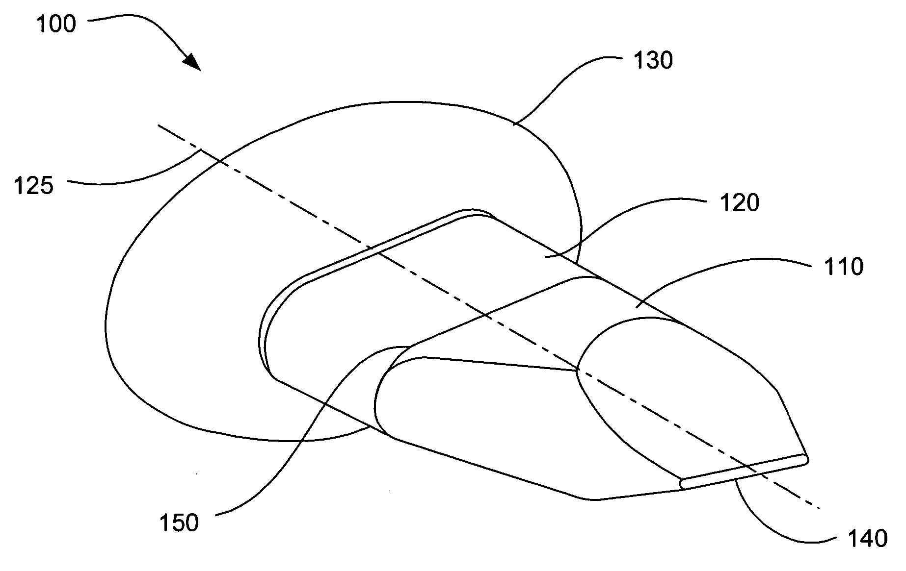 Distractible interspinous process implant and method of implantation