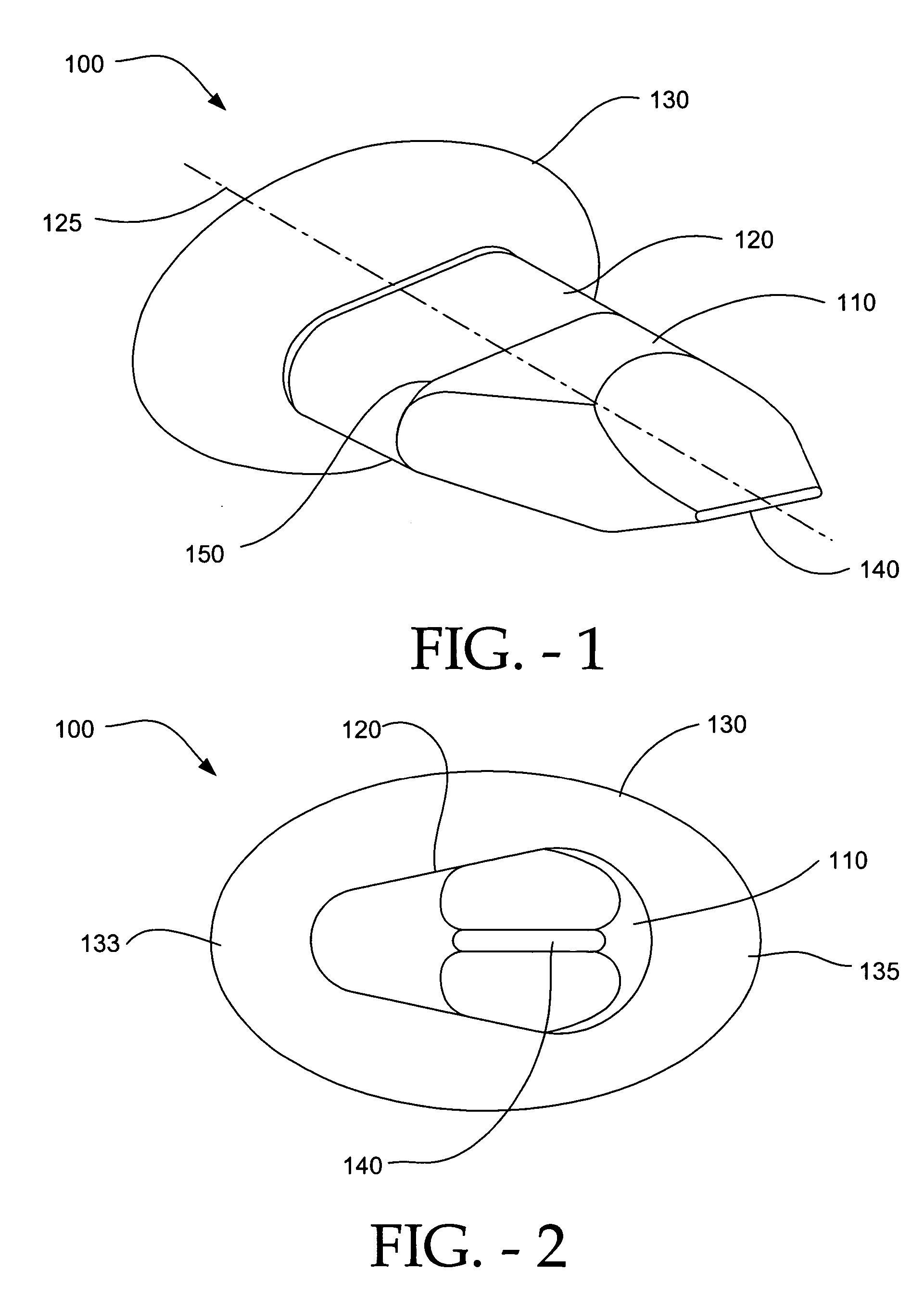Distractible interspinous process implant and method of implantation