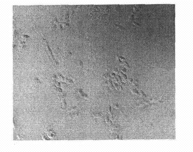 Pharmaceutical composition for treating Alzheimer disease (AD), and preparation method and application thereof