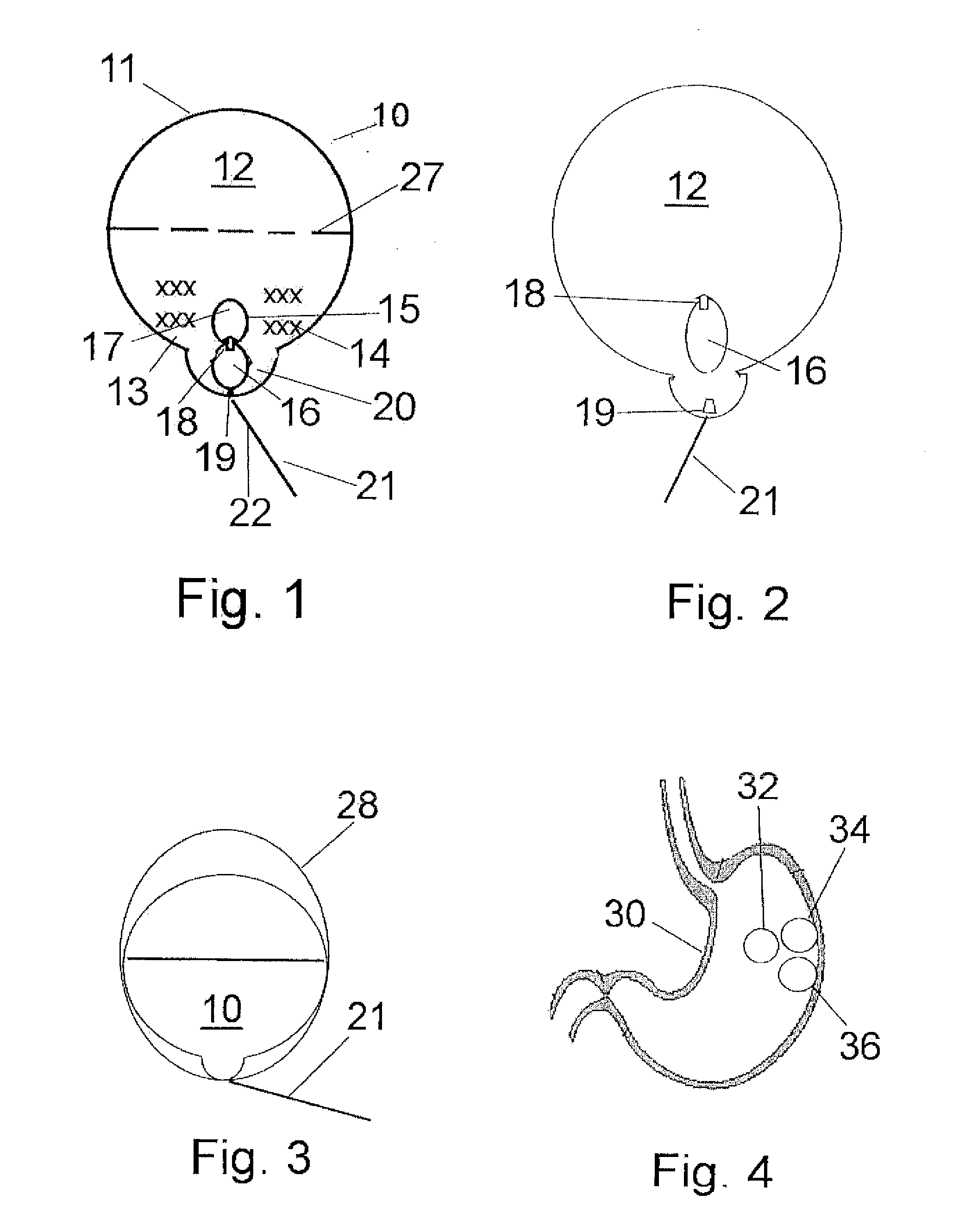 Self-inflating and deflating intragastric balloon implant device