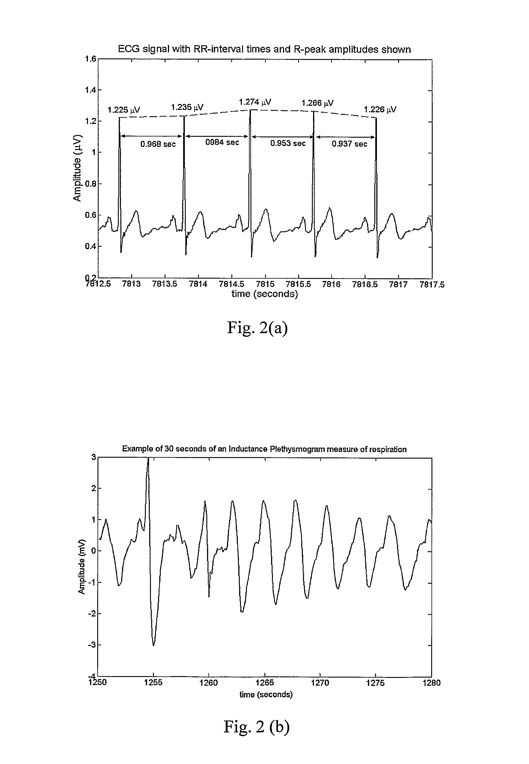 Sleep monitoring system