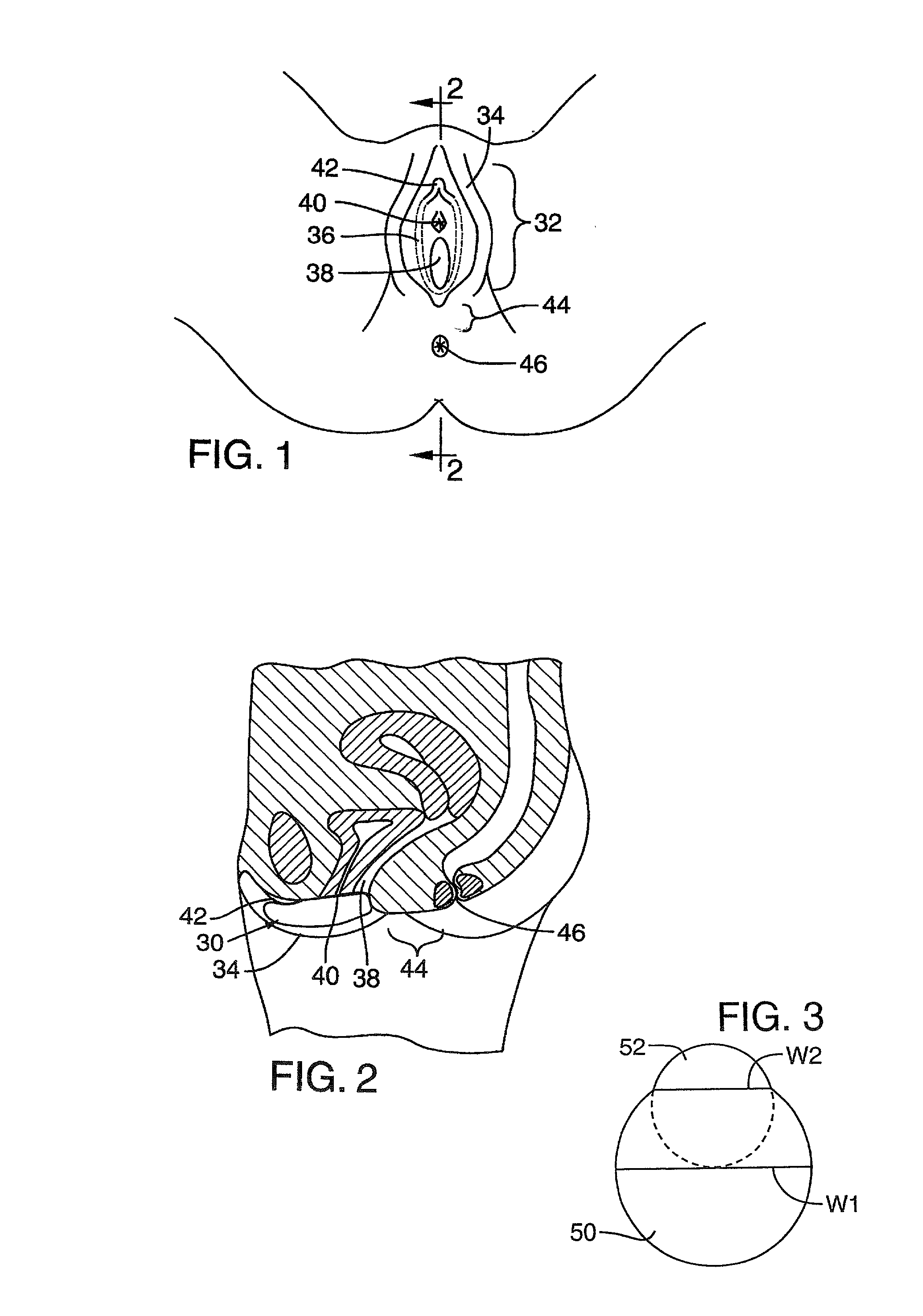 Administration of therapeutic or diagnostic agents using interlabial pad
