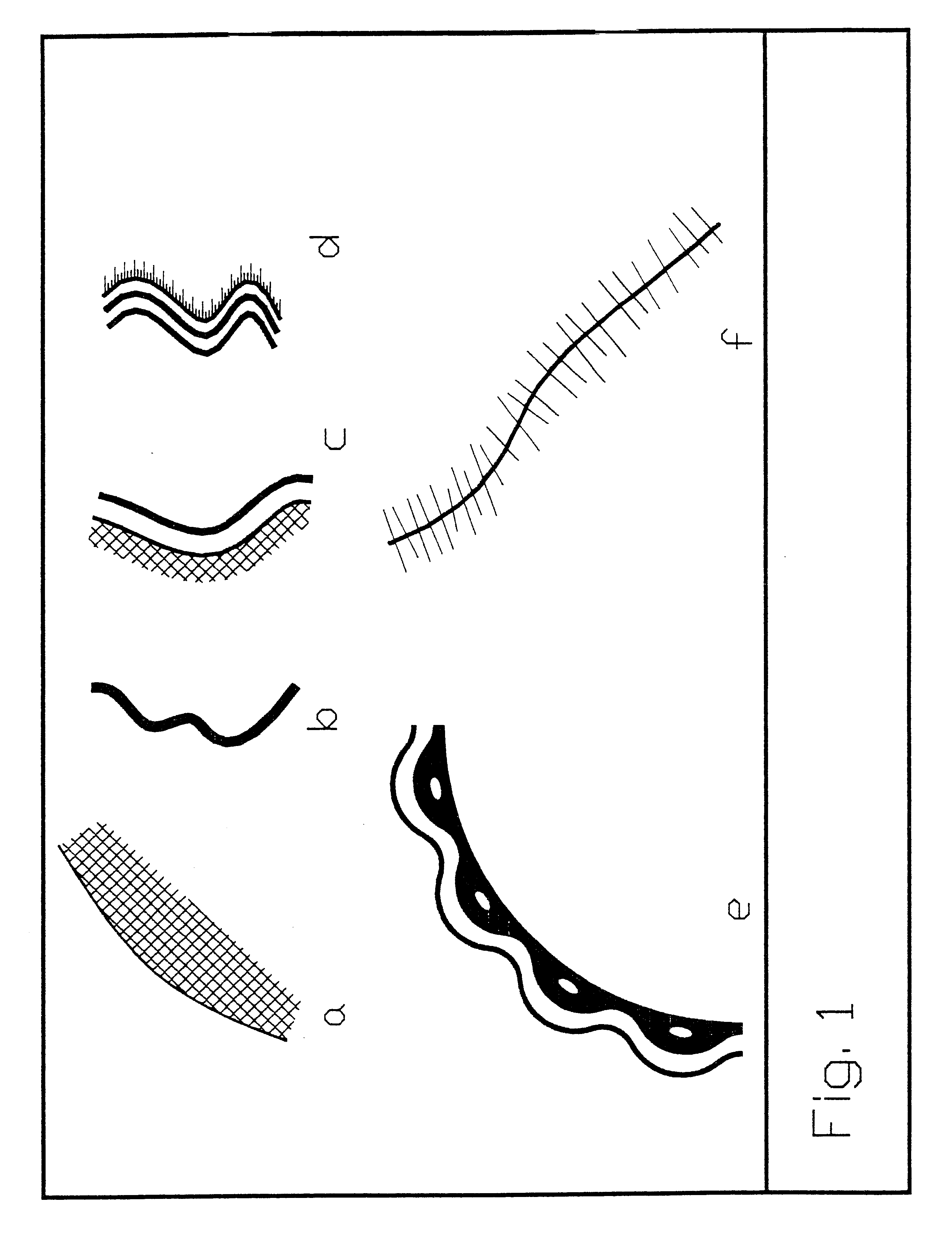 Method and apparatus for image analysis and processing by identification of characteristic lines and corresponding parameters