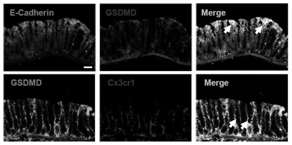 Application of gsdmd protein and its target in the preparation of drugs for treating inflammatory bowel disease