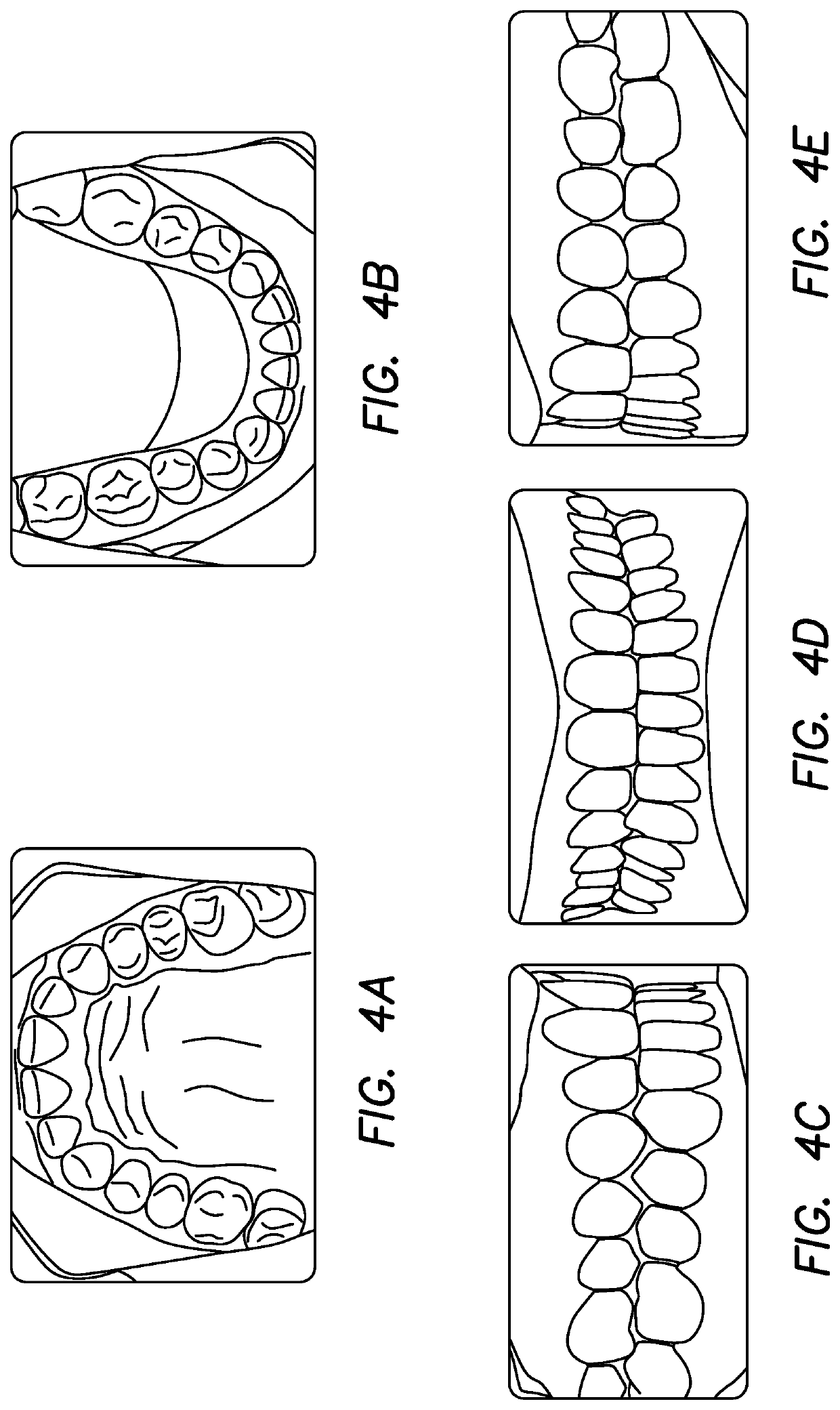 Orthodontic Appliance for Use During Orthognathic Surgery and Method for Using the Same