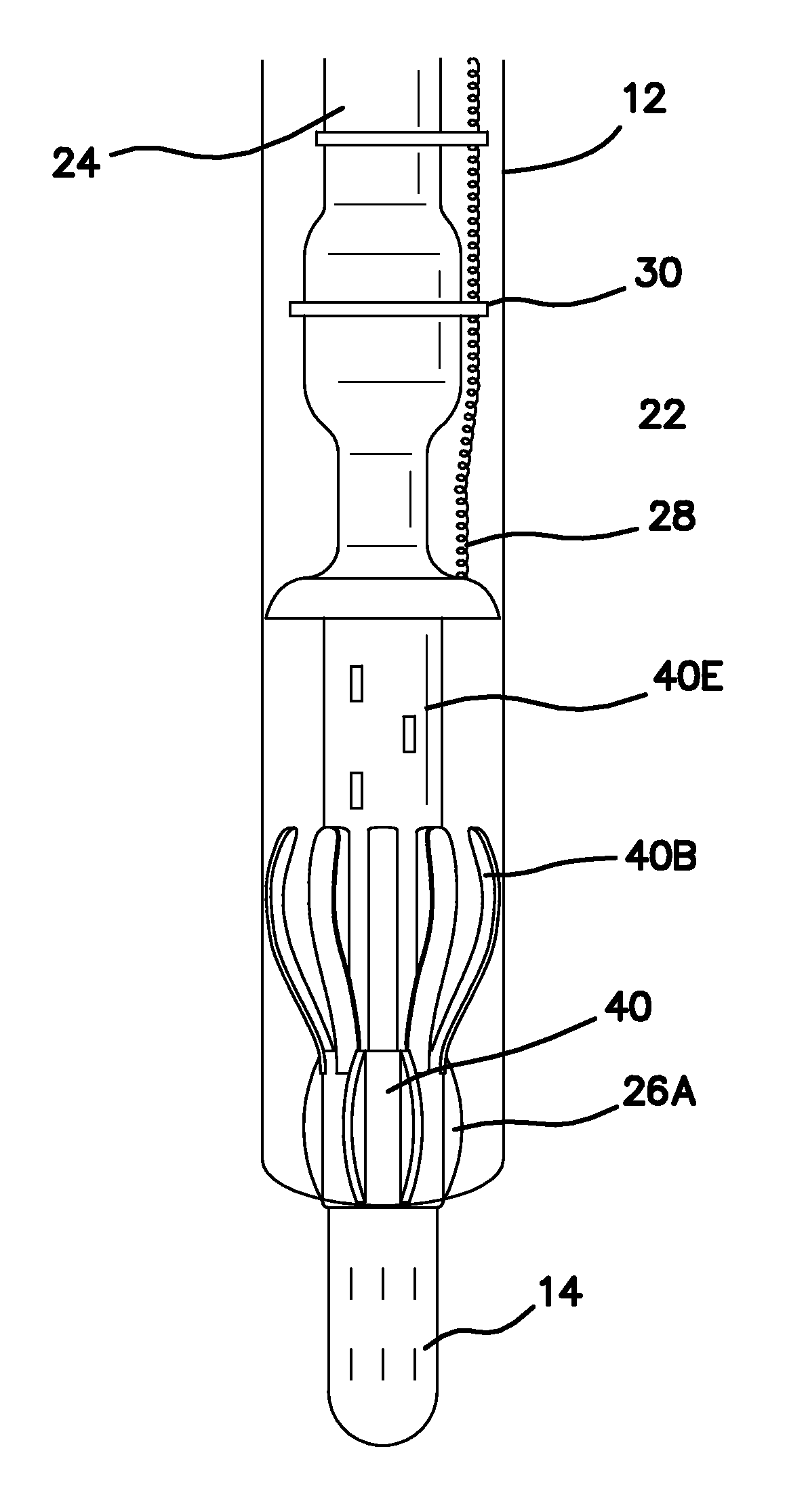 Electric Submersible Pump Band Basket Catcher