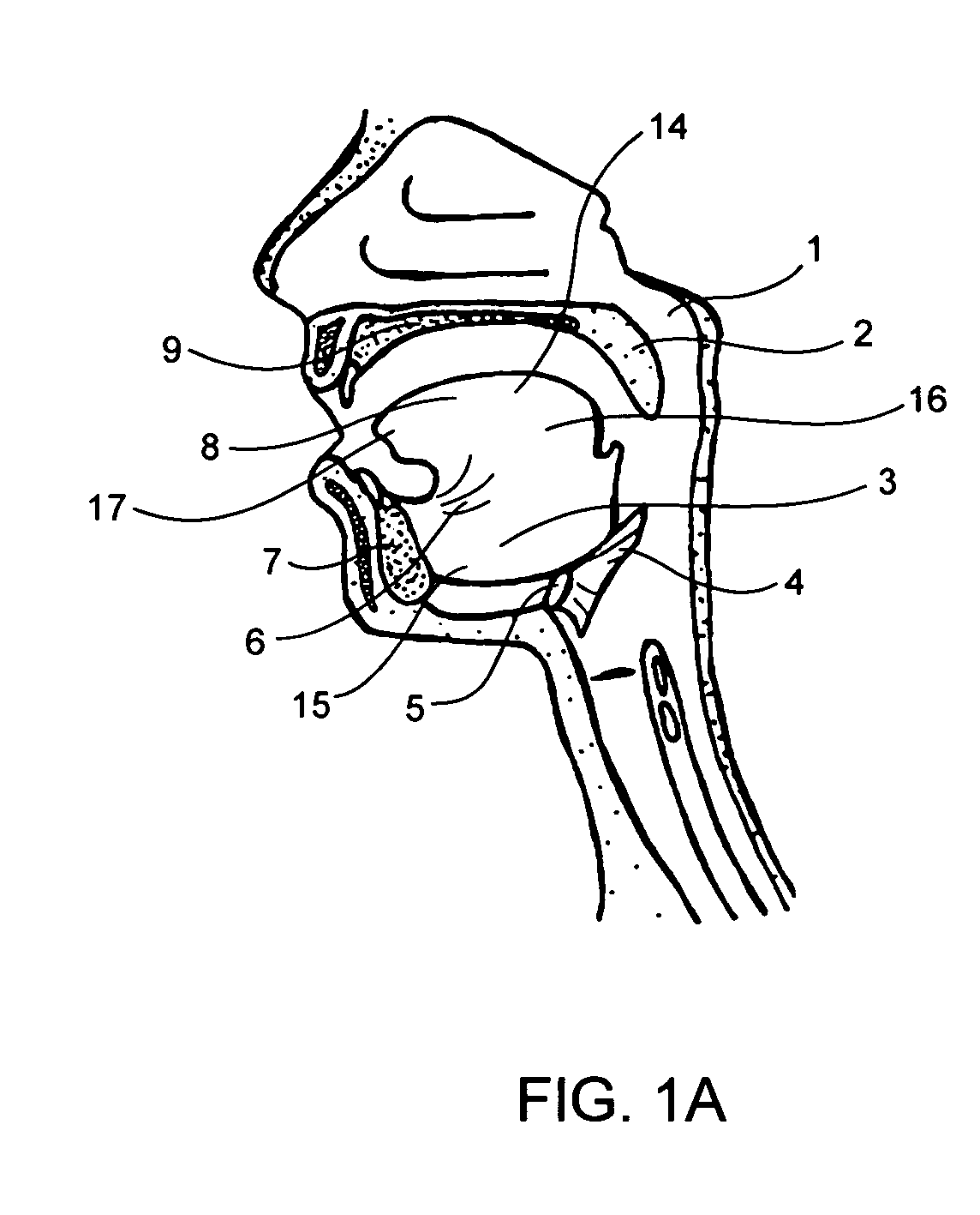 System to prevent airway obstruction