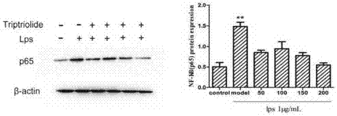 Novel low-toxicity tripterygium polyglycoside, and preparation method and applications thereof