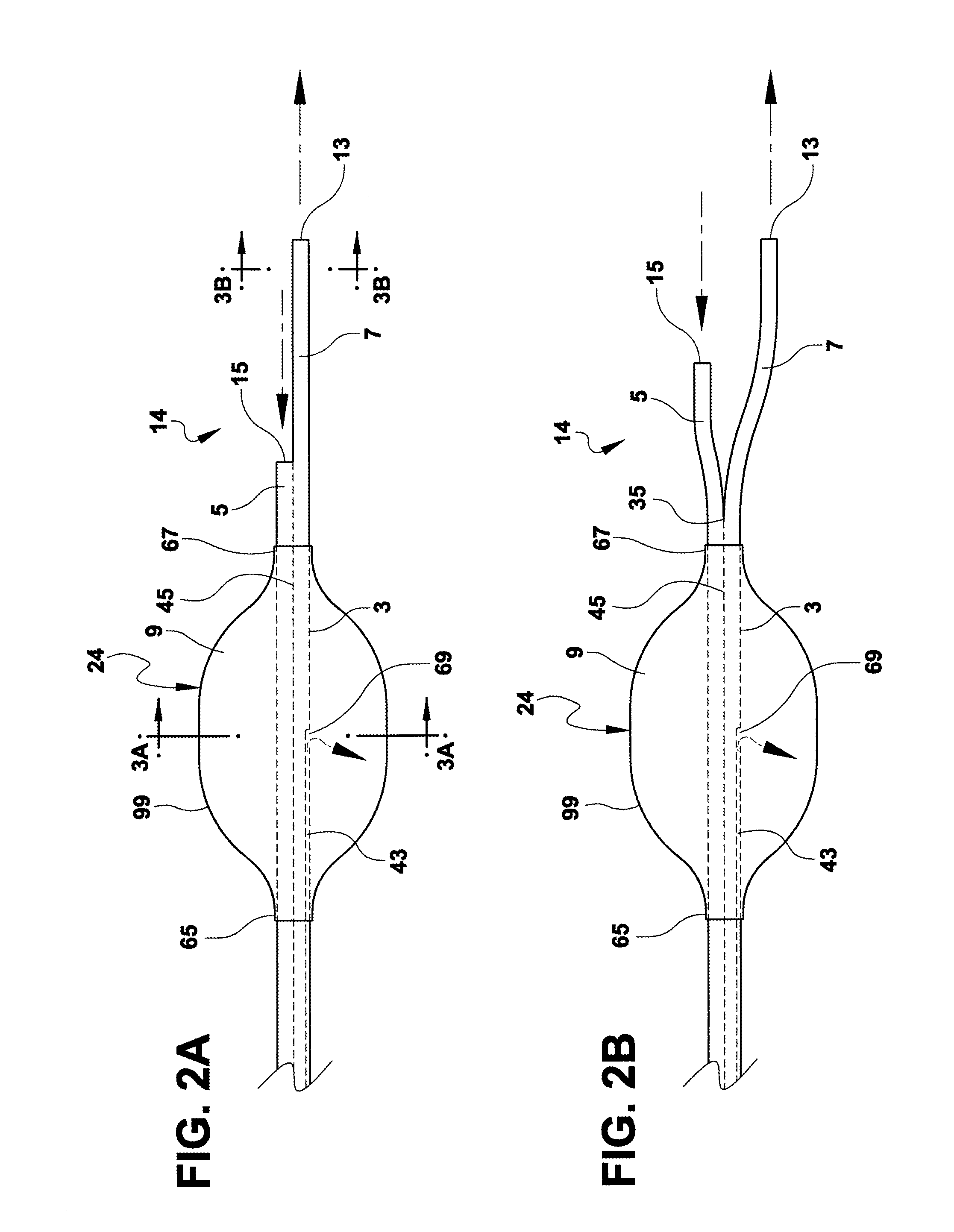 Bronchial catheter and method of use