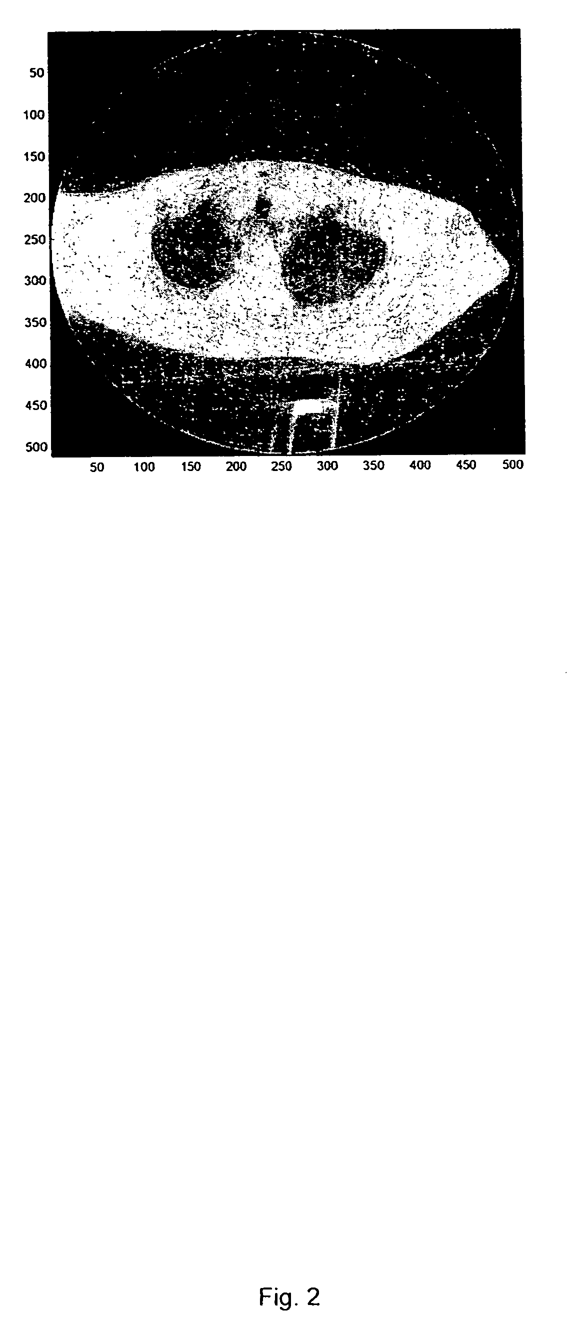 System and method for correcting for ring artifacts in an image