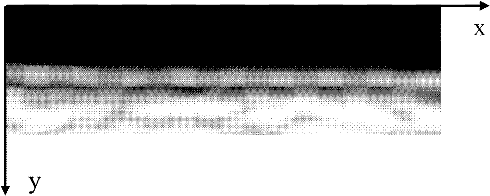 Method for automatic computerized segmentation and analysis on thickness uniformity of intima media of carotid artery blood wall in sonographic image