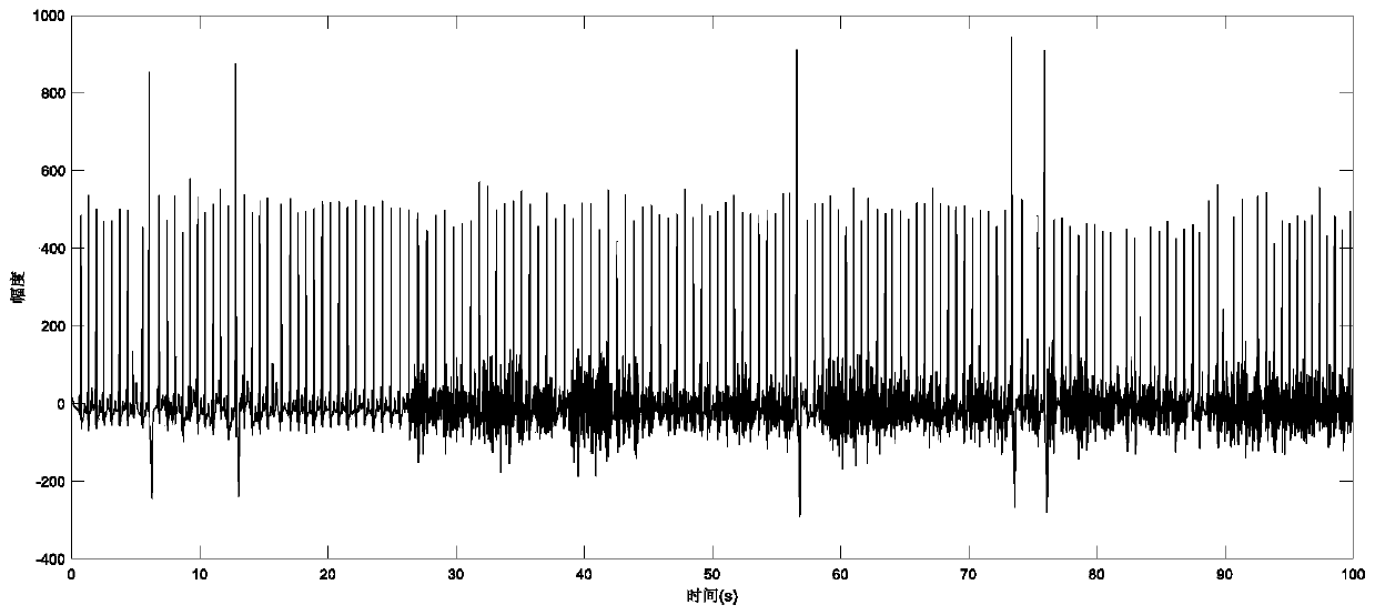Improved electrocardiosignal quick clustering analysis method