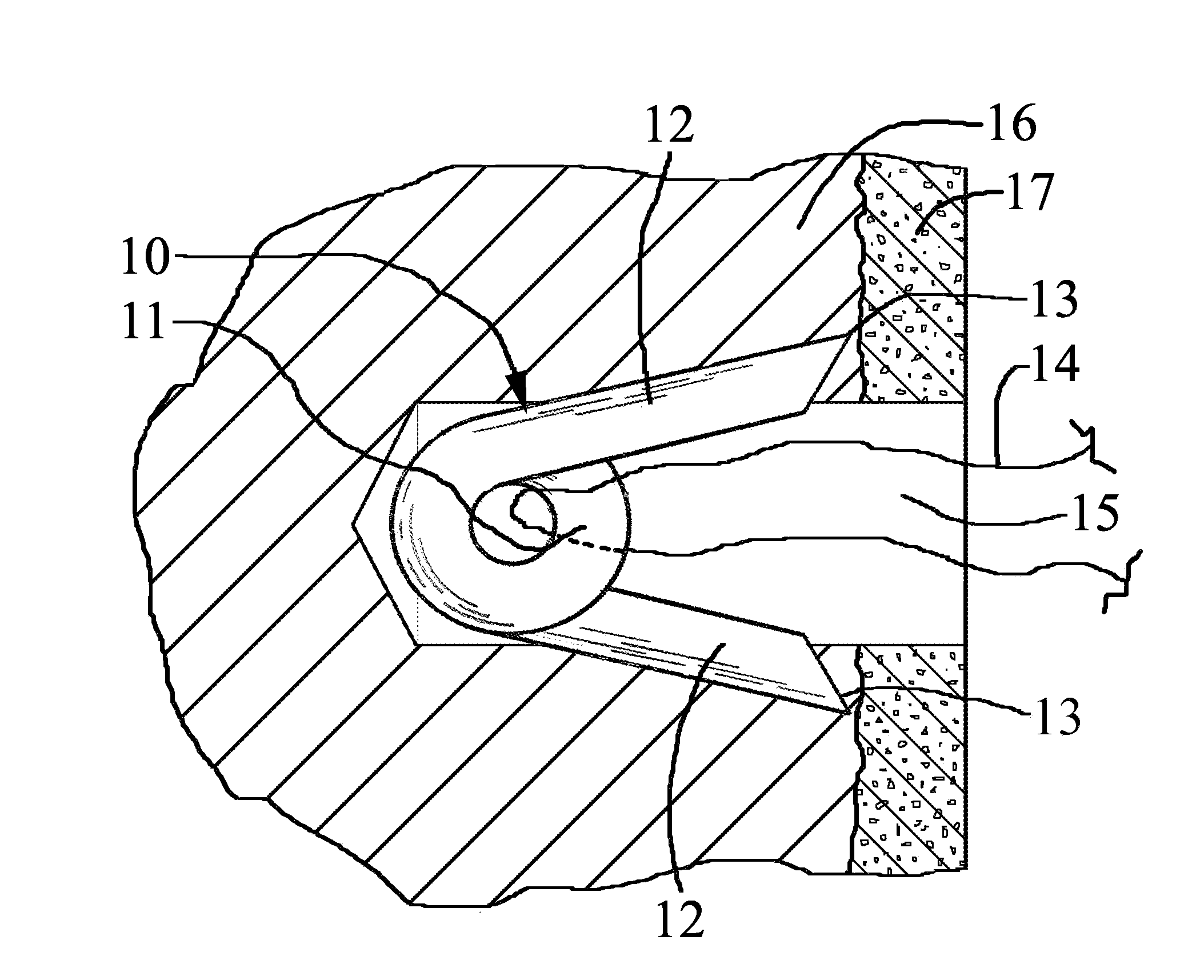 Suture anchor and method for attaching soft tissue to bone