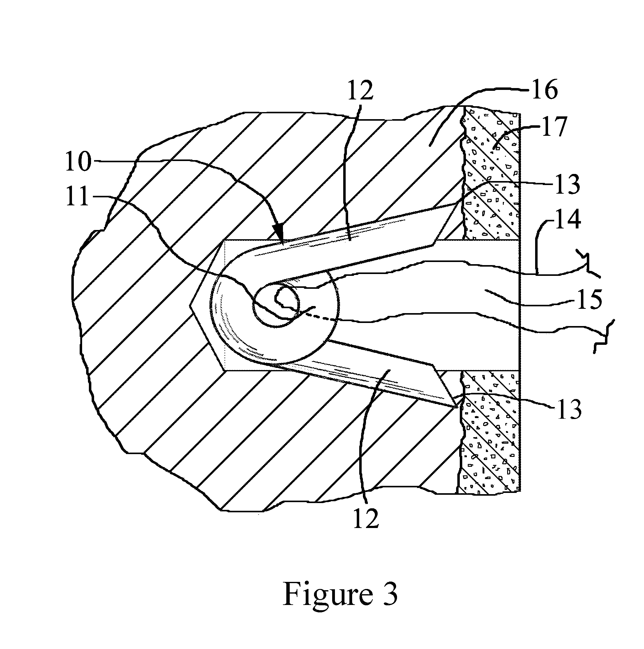 Suture anchor and method for attaching soft tissue to bone