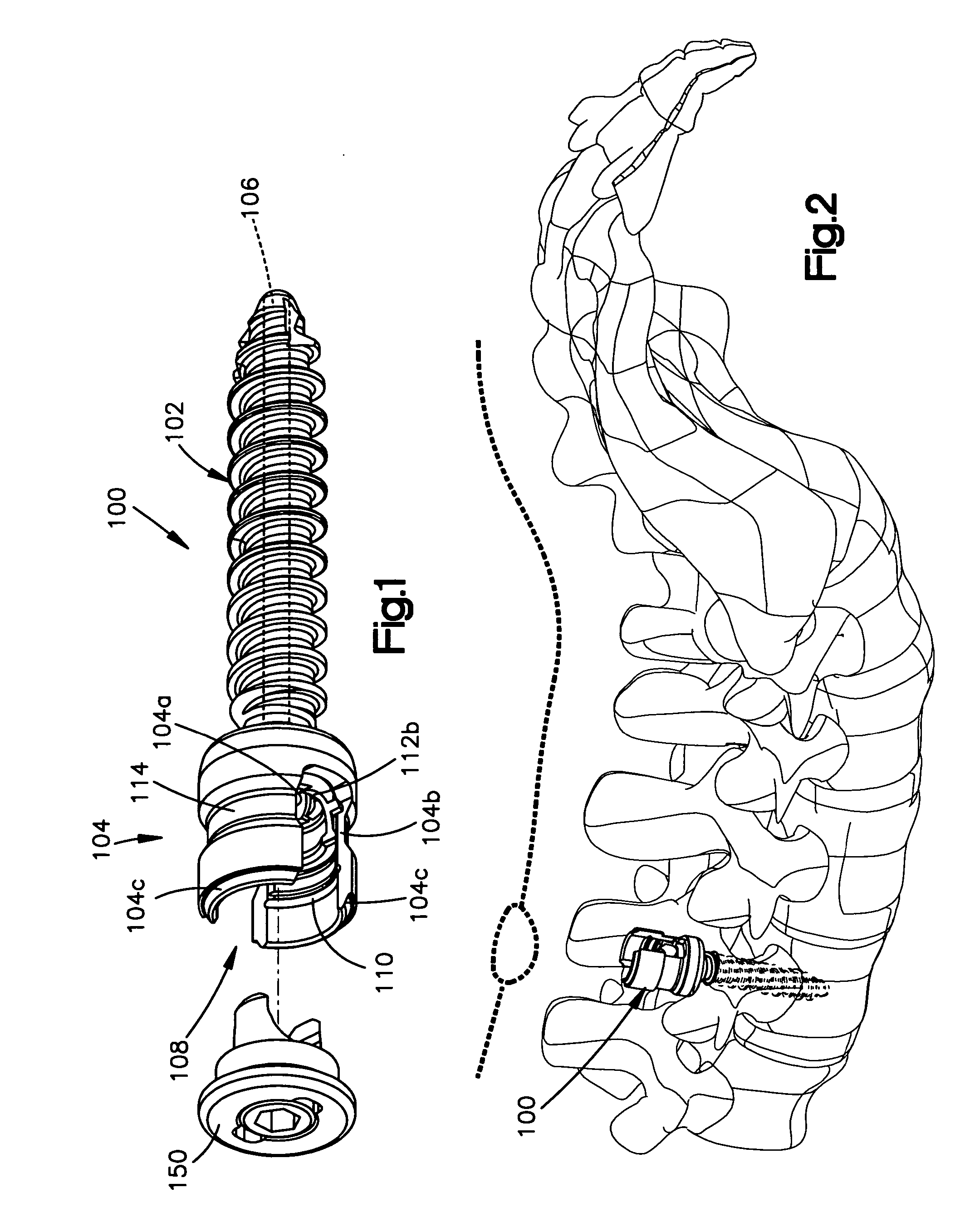 Methods of spinal fixation and instrumentation