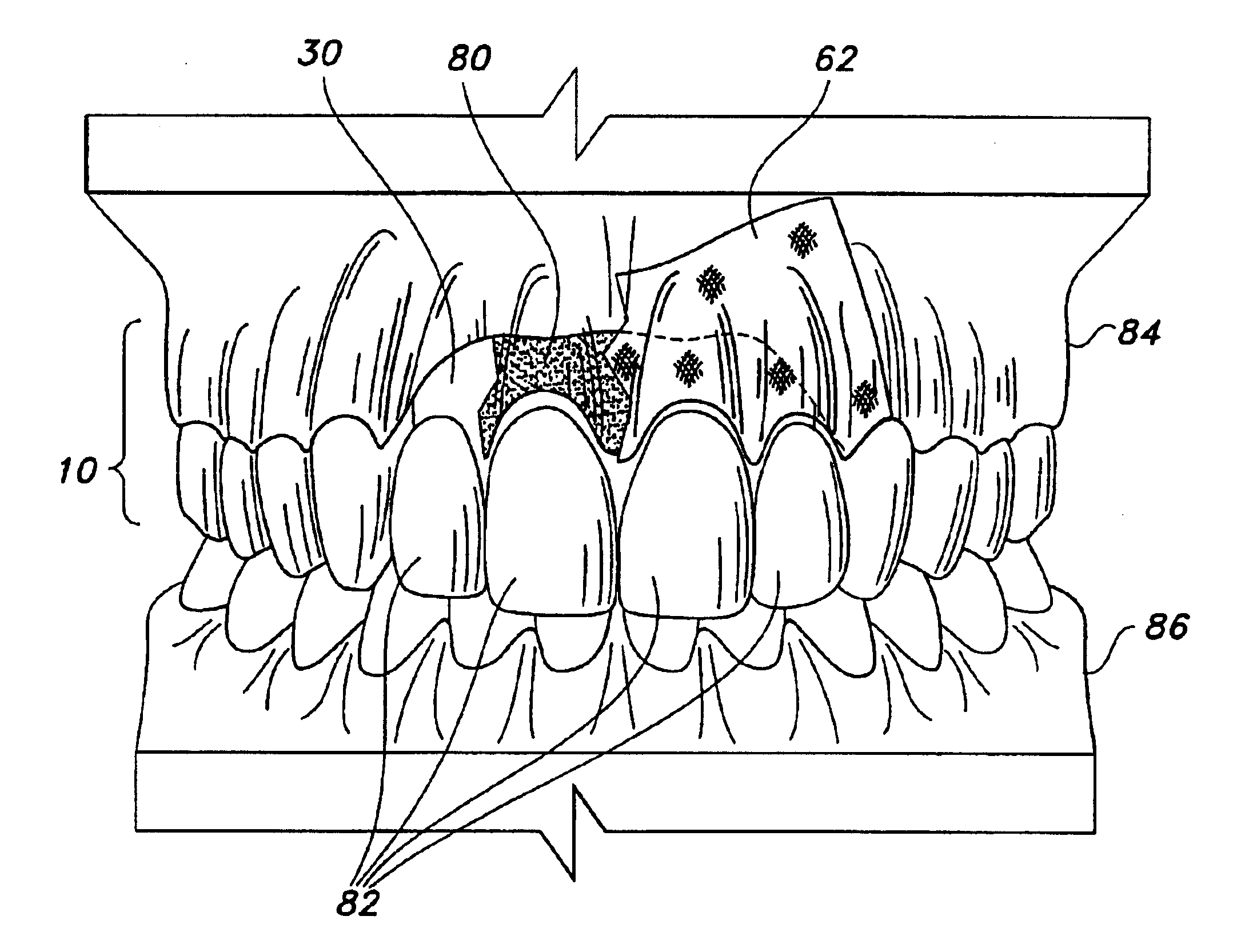 Biocompatible form and method of fabrication