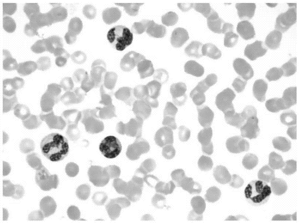 White blood cell segmentation method based on super pixels and anomaly detection color blood cell image