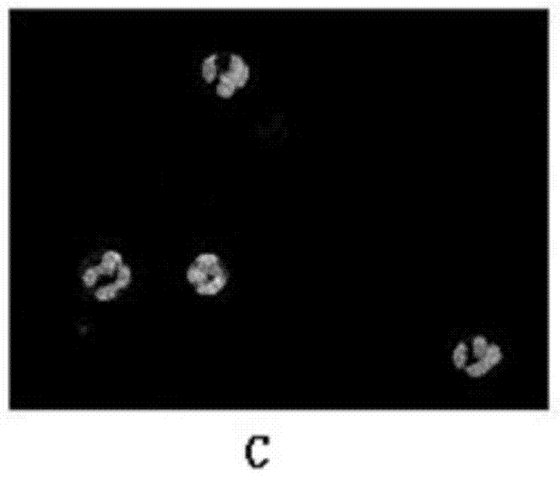 White blood cell segmentation method based on super pixels and anomaly detection color blood cell image