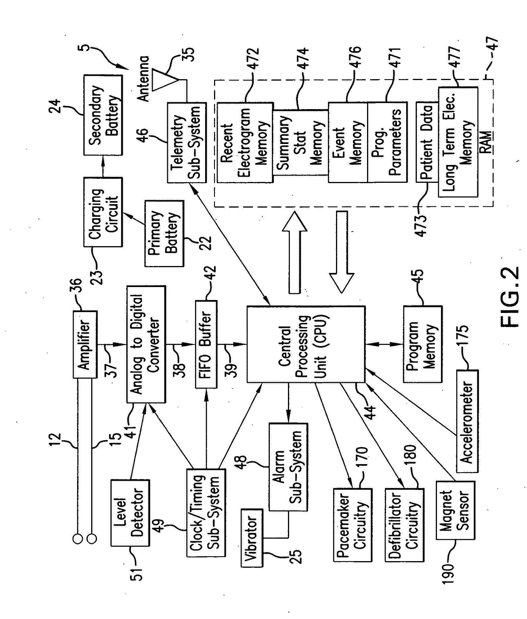 System and methods for the selective updating of heart signal parameter time series
