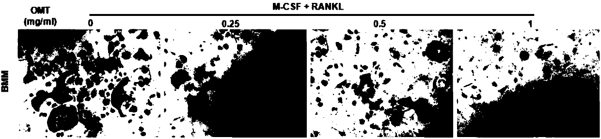 Application of oxymatrine to preparation of medicine for resisting osteoclast-mediated bone loss