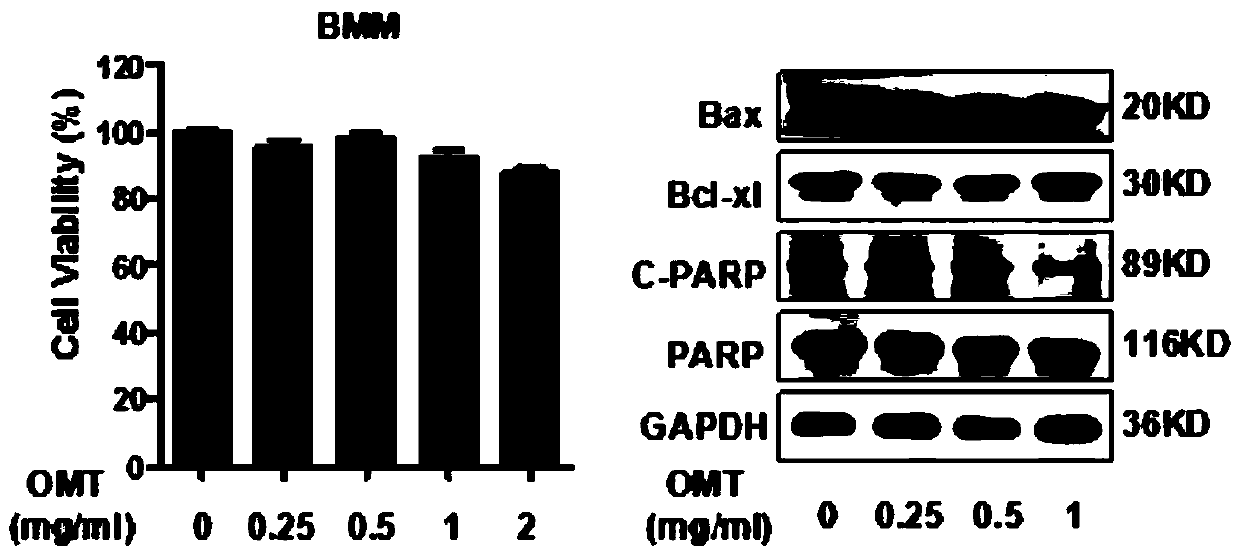 Application of oxymatrine to preparation of medicine for resisting osteoclast-mediated bone loss