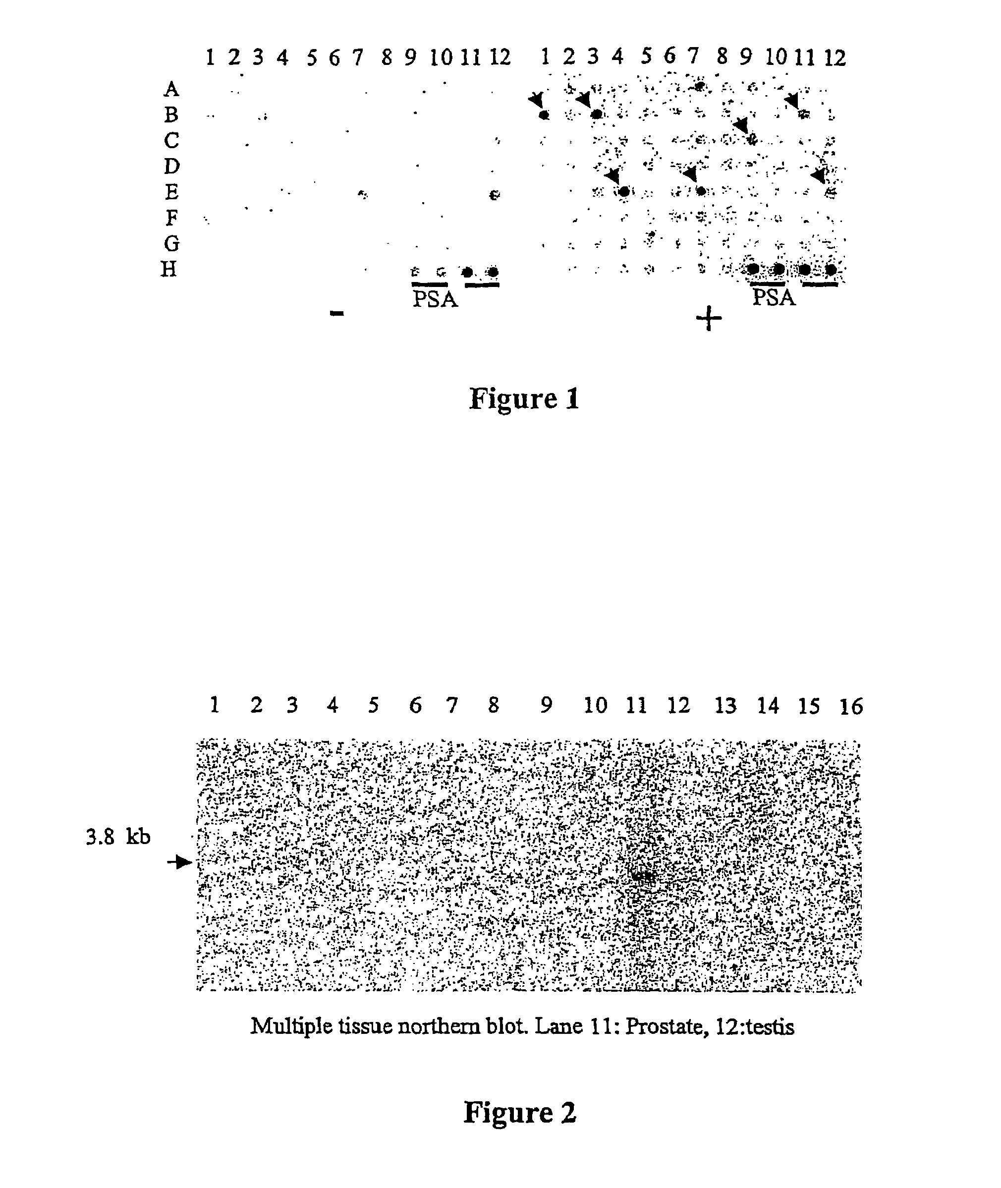 Prostate-specific or testis-specific nucleic acid molecules, polypeptides, and diagnostic and therapeutic methods